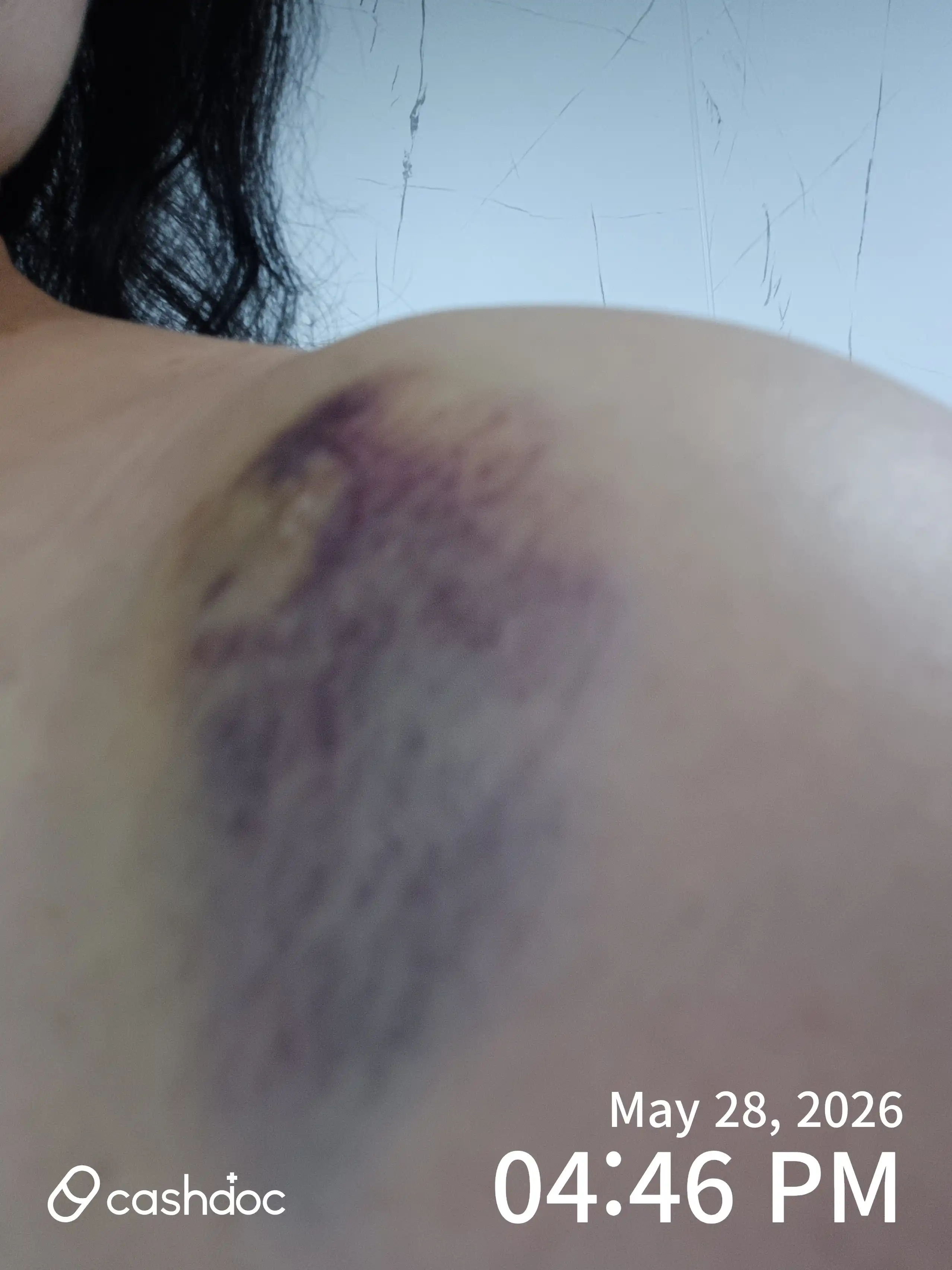 Review photo