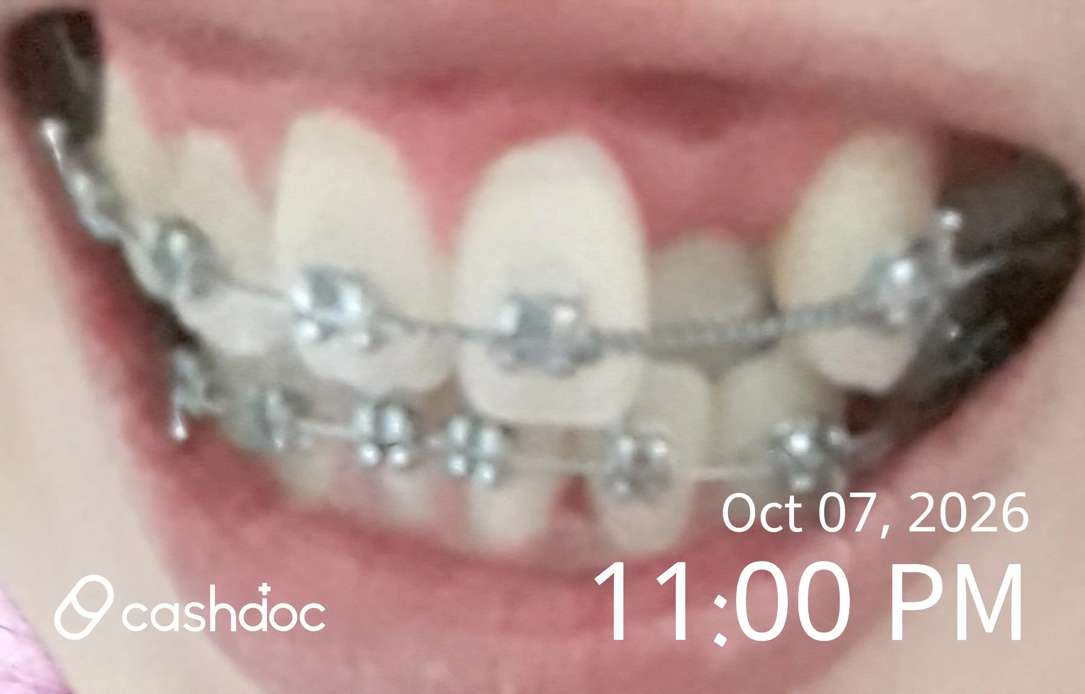 Pretty Smile Barun Dental Clinic review photo