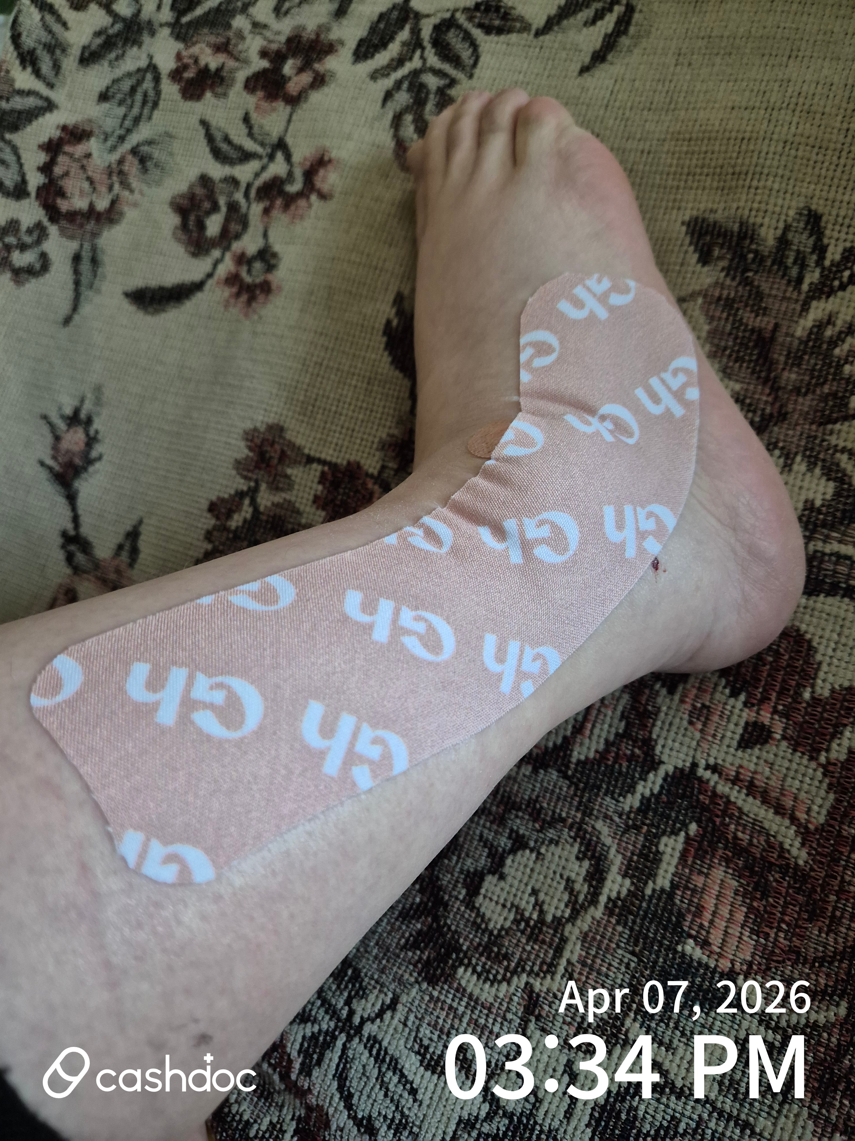 용산좋은습관마취통증의학과의원에서 손목 통증 관리 팁 배워요