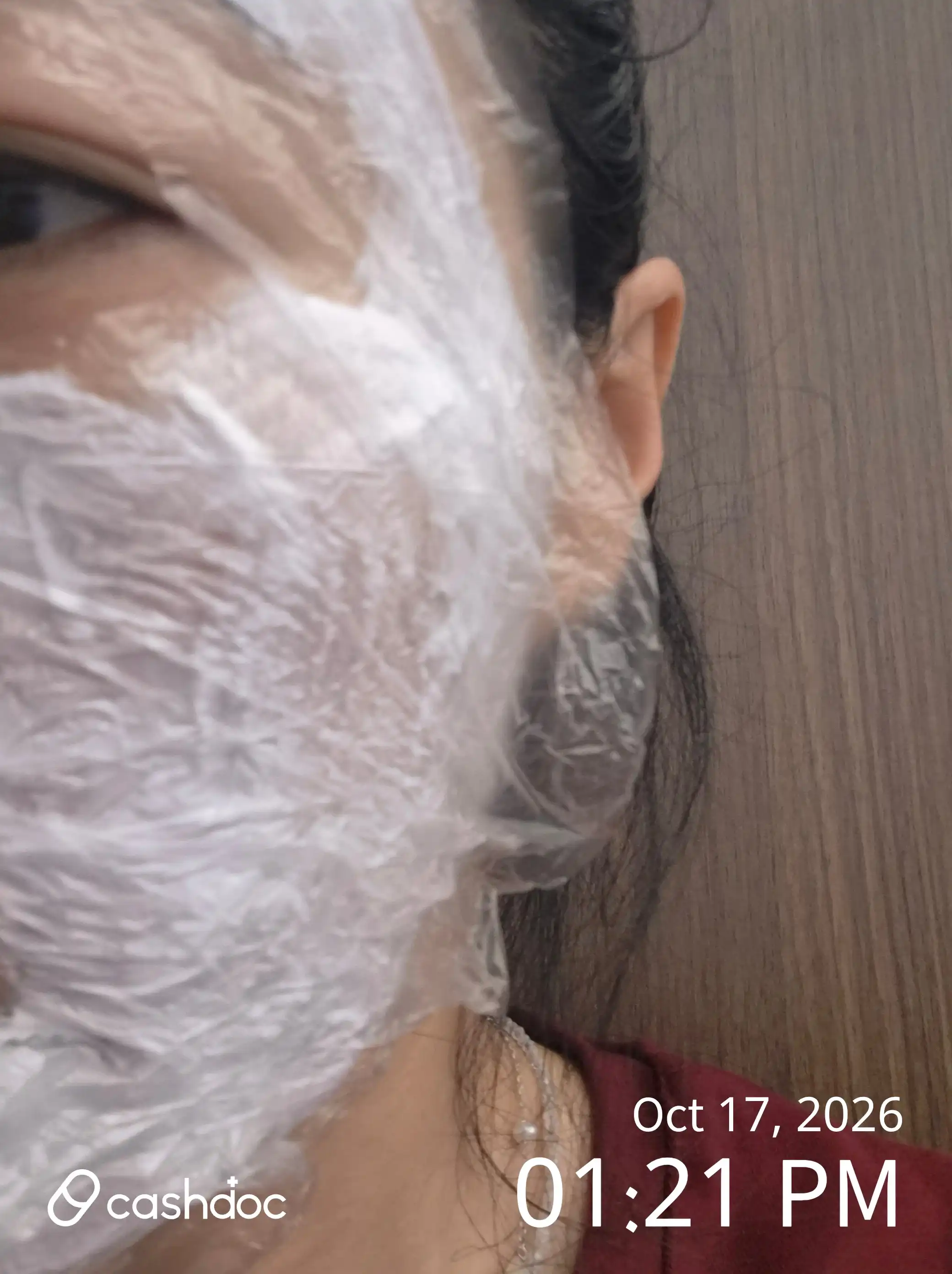 美璞诊所 东柏分院 评价照片