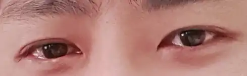 전