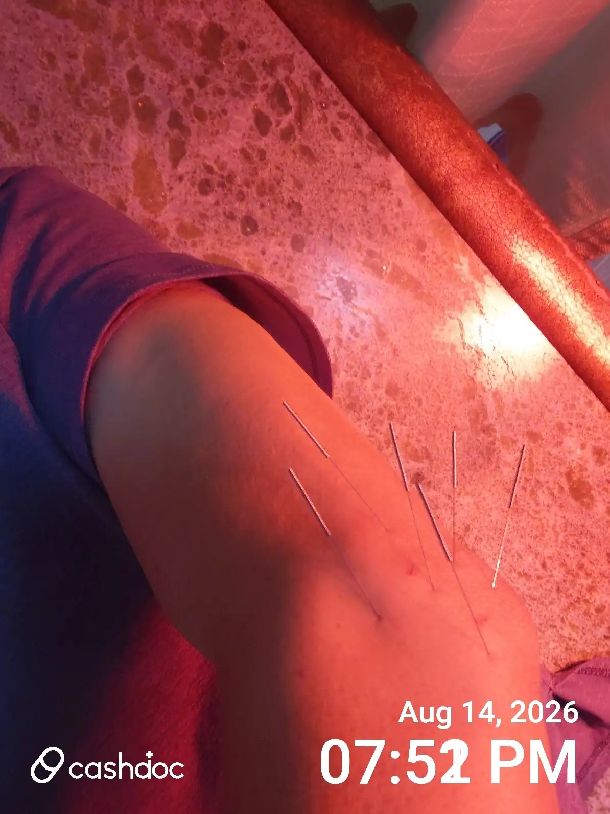评价照片