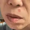 전
