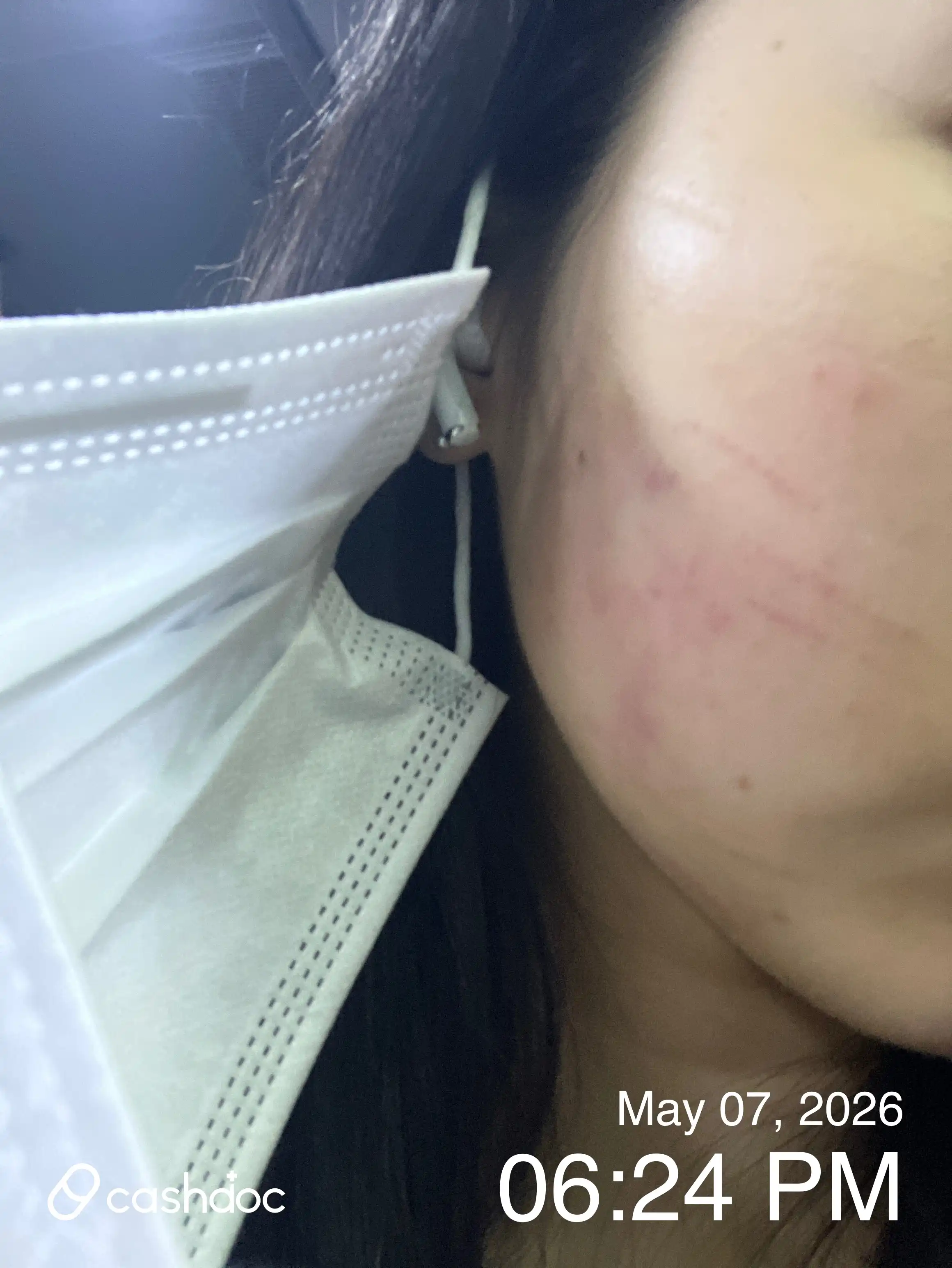 Review photo