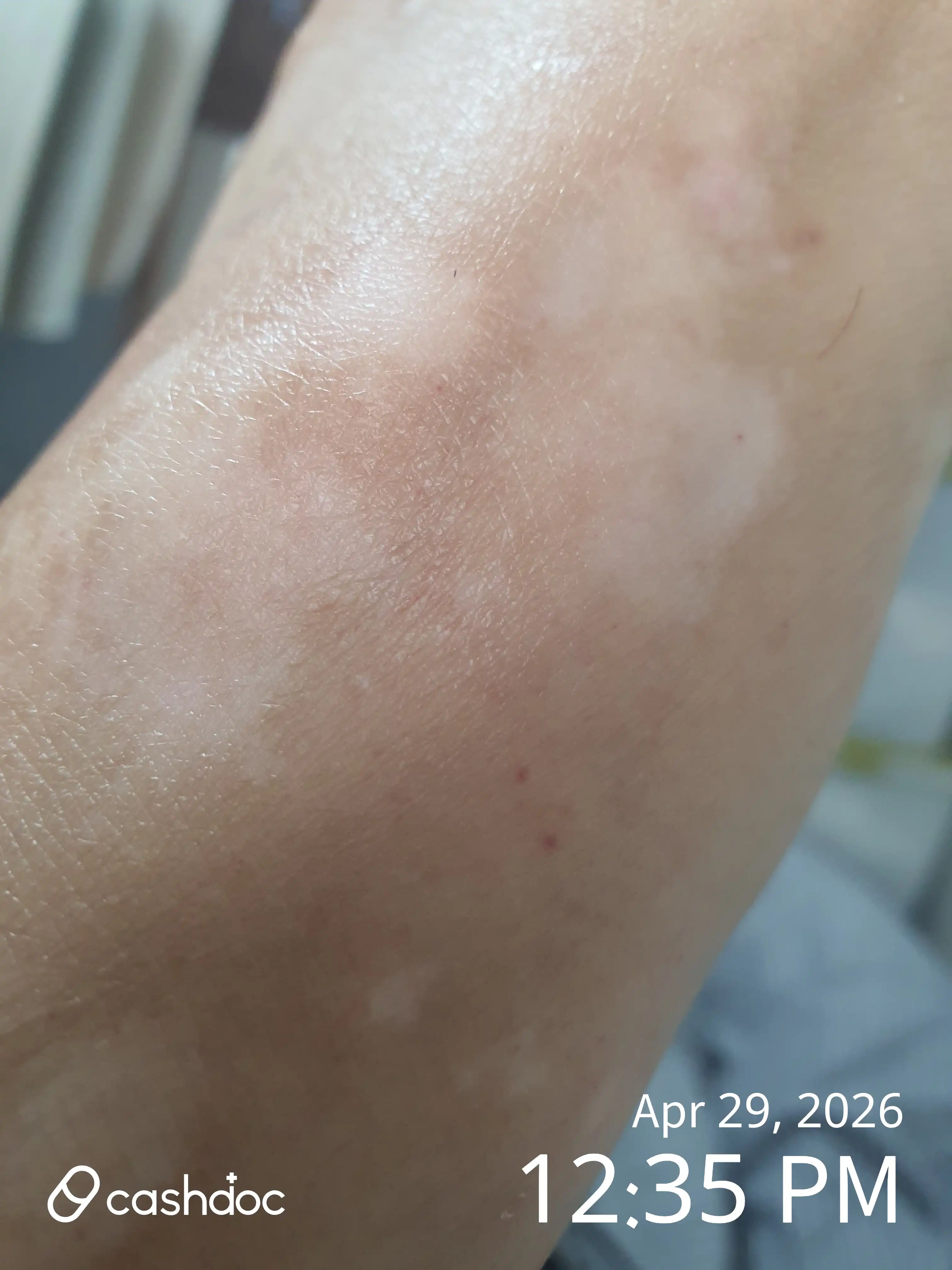Review photo