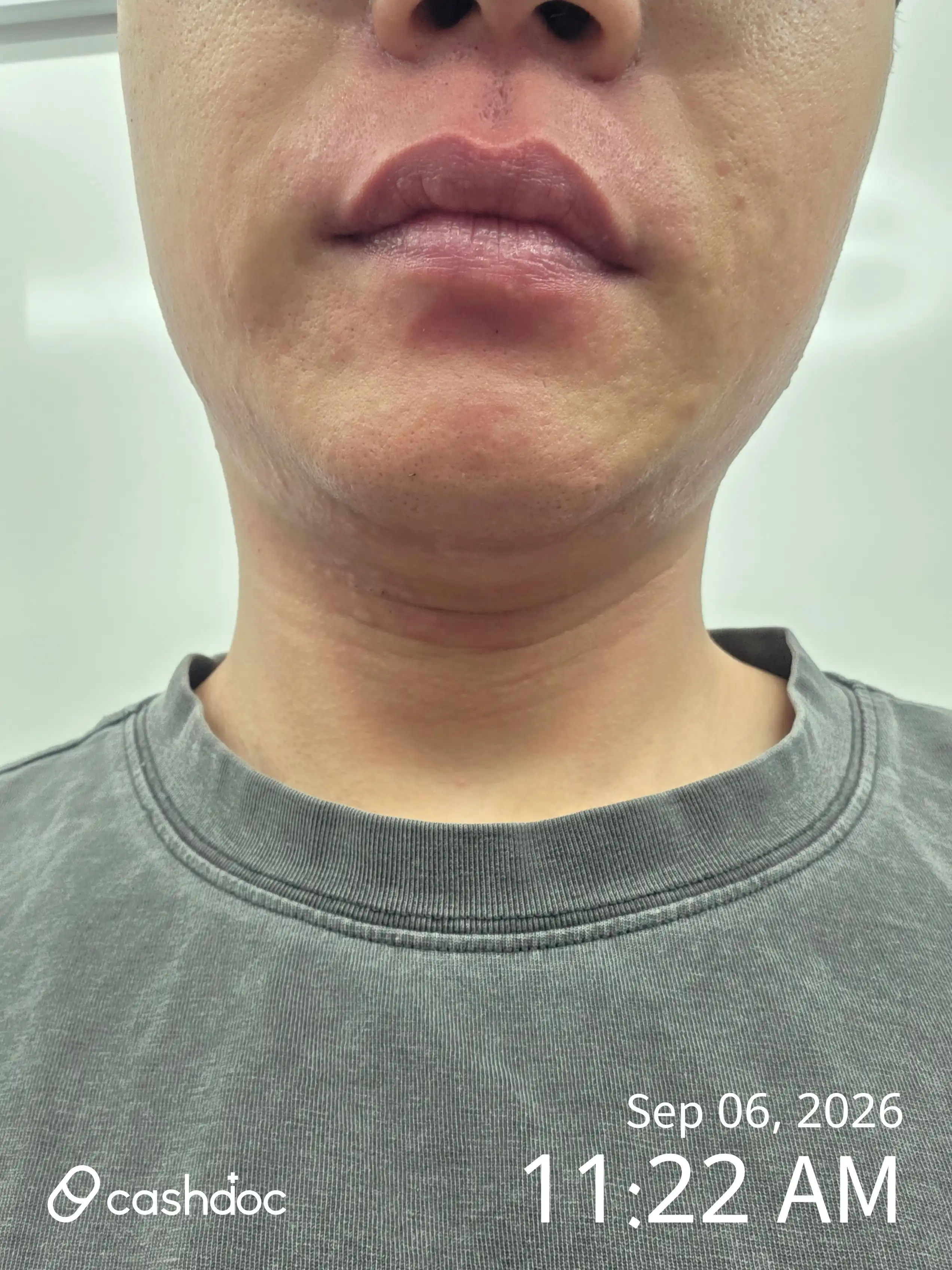 Review photo
