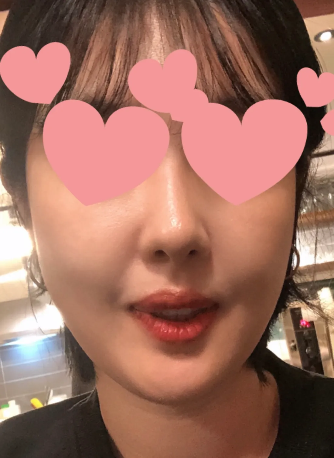 项目前 — 舒适睡眠瑞居兰注射剂 2cc