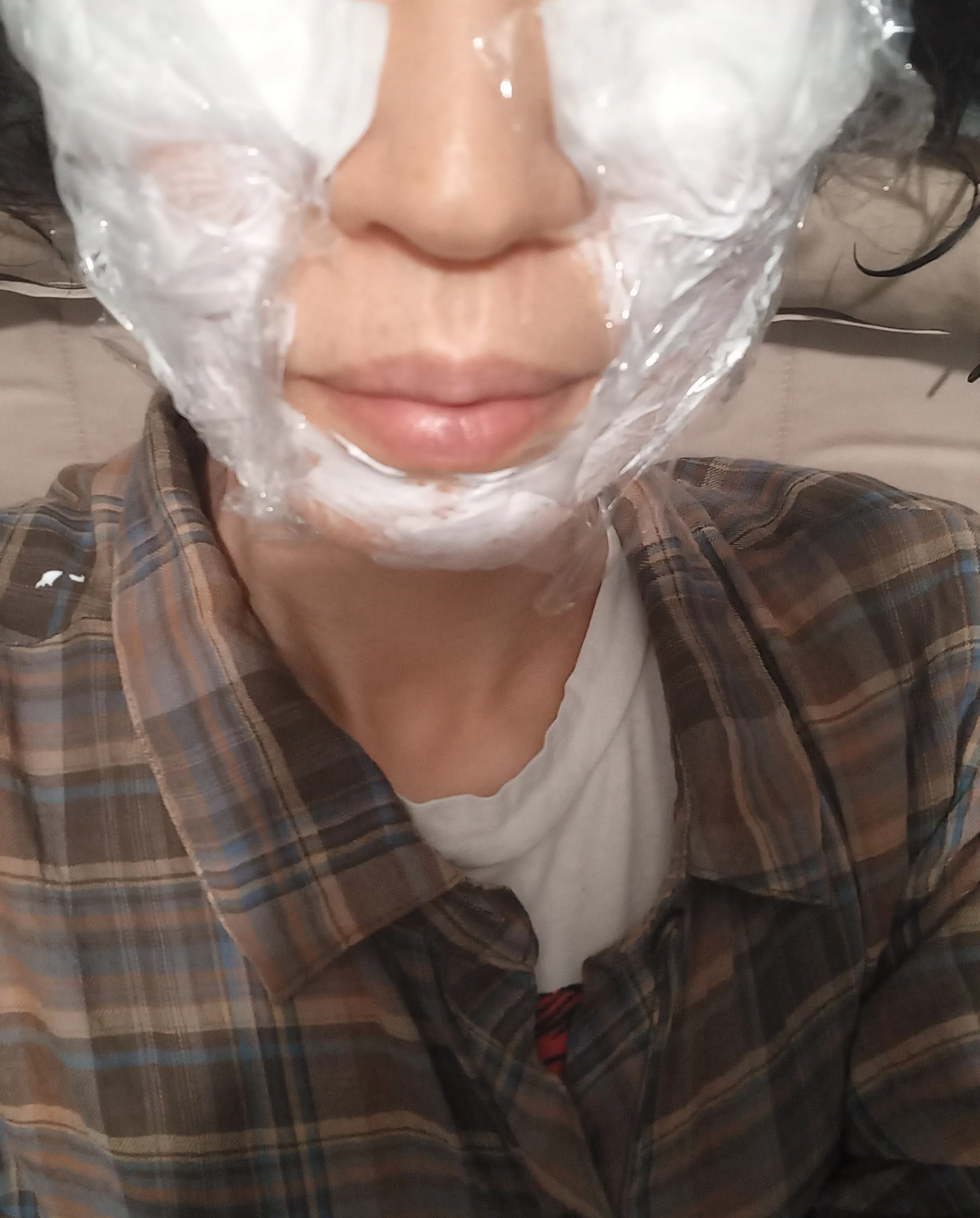 시술 전 사진