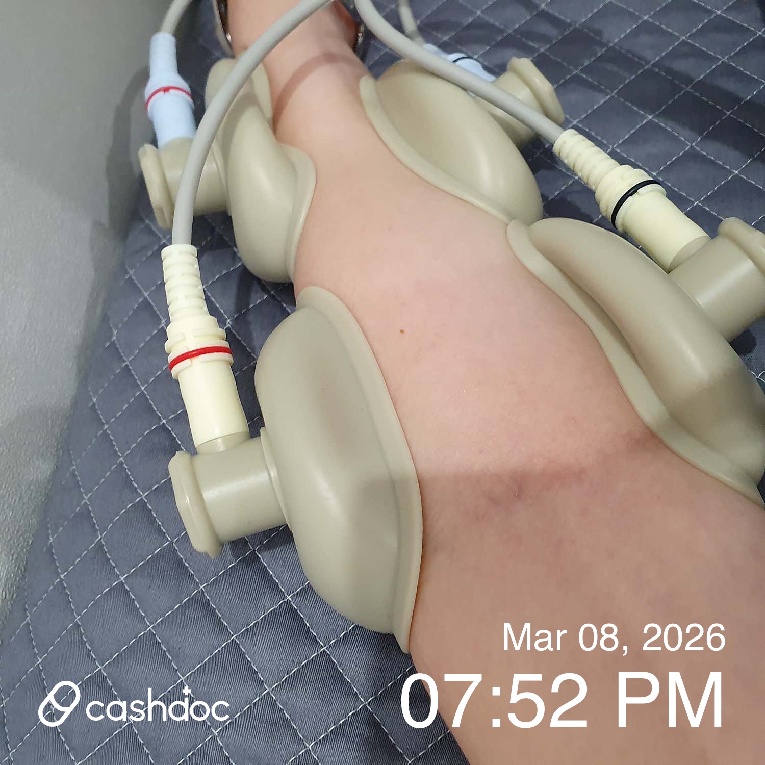 세종온정성한의원에서 침도 안 아프고 약도 편해요