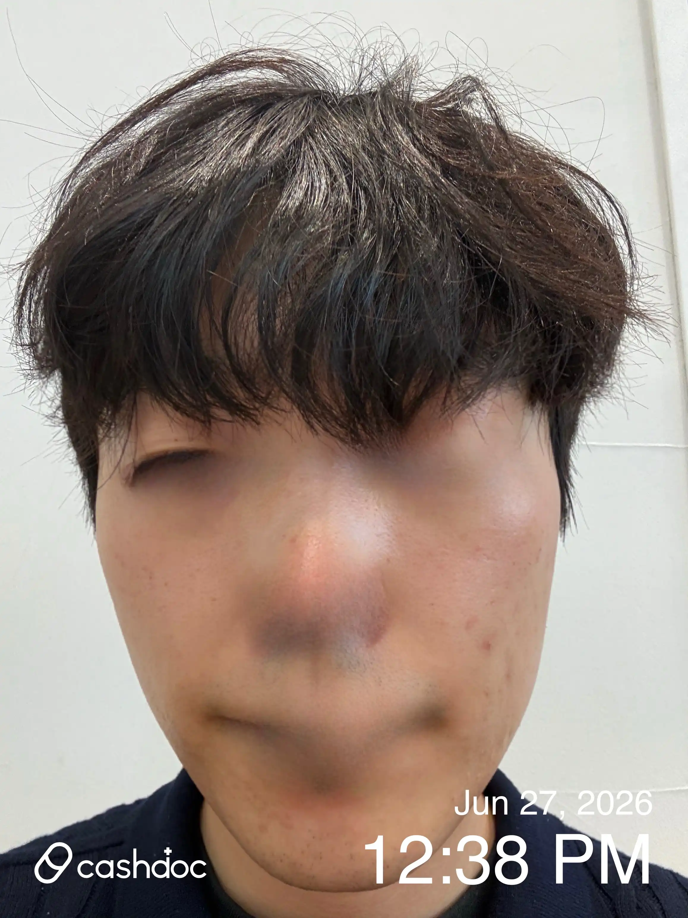 리뷰 사진