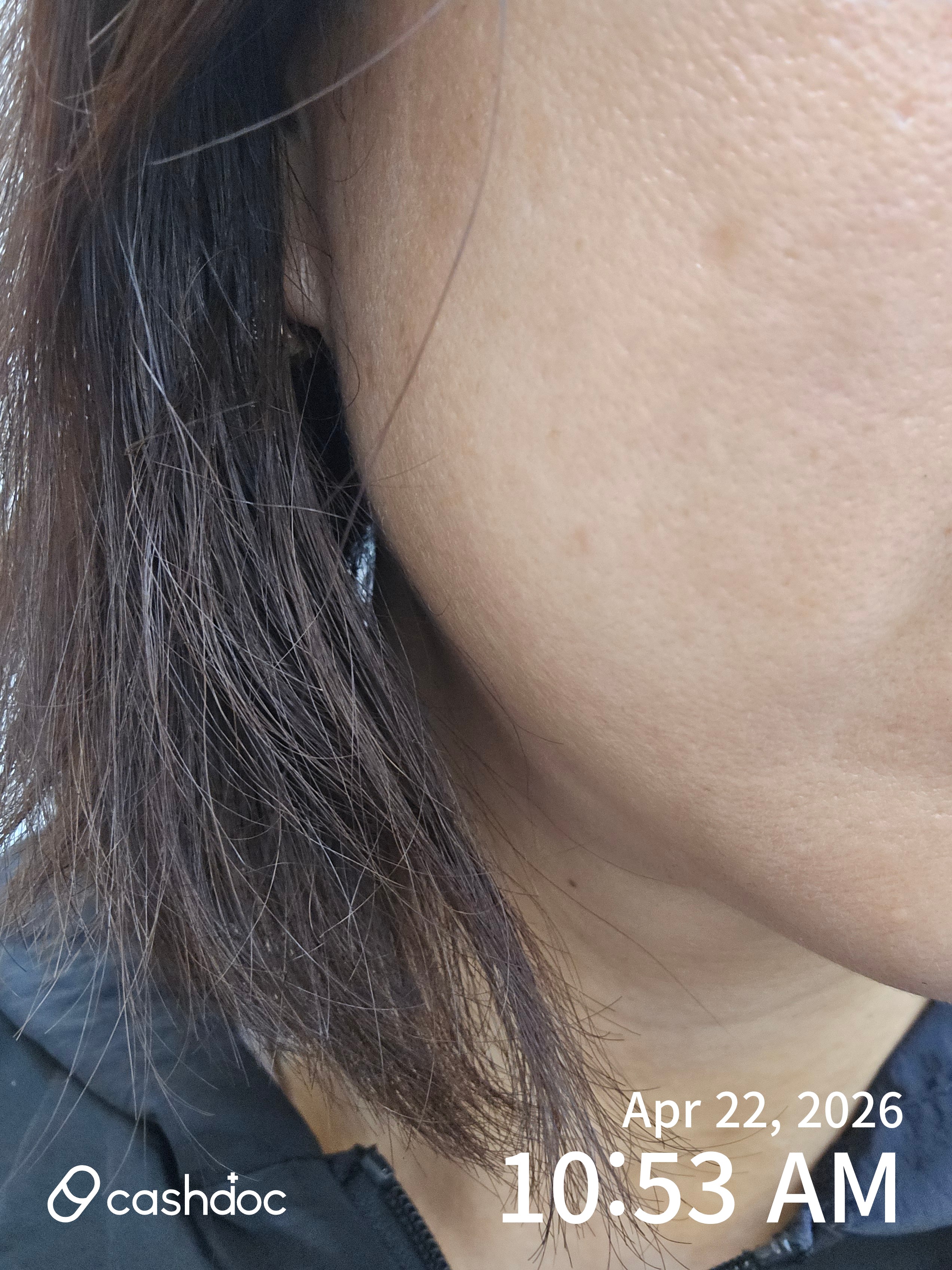 고양시 메이퓨어의원 화정점, 가성비와 친절함이 돋보여요