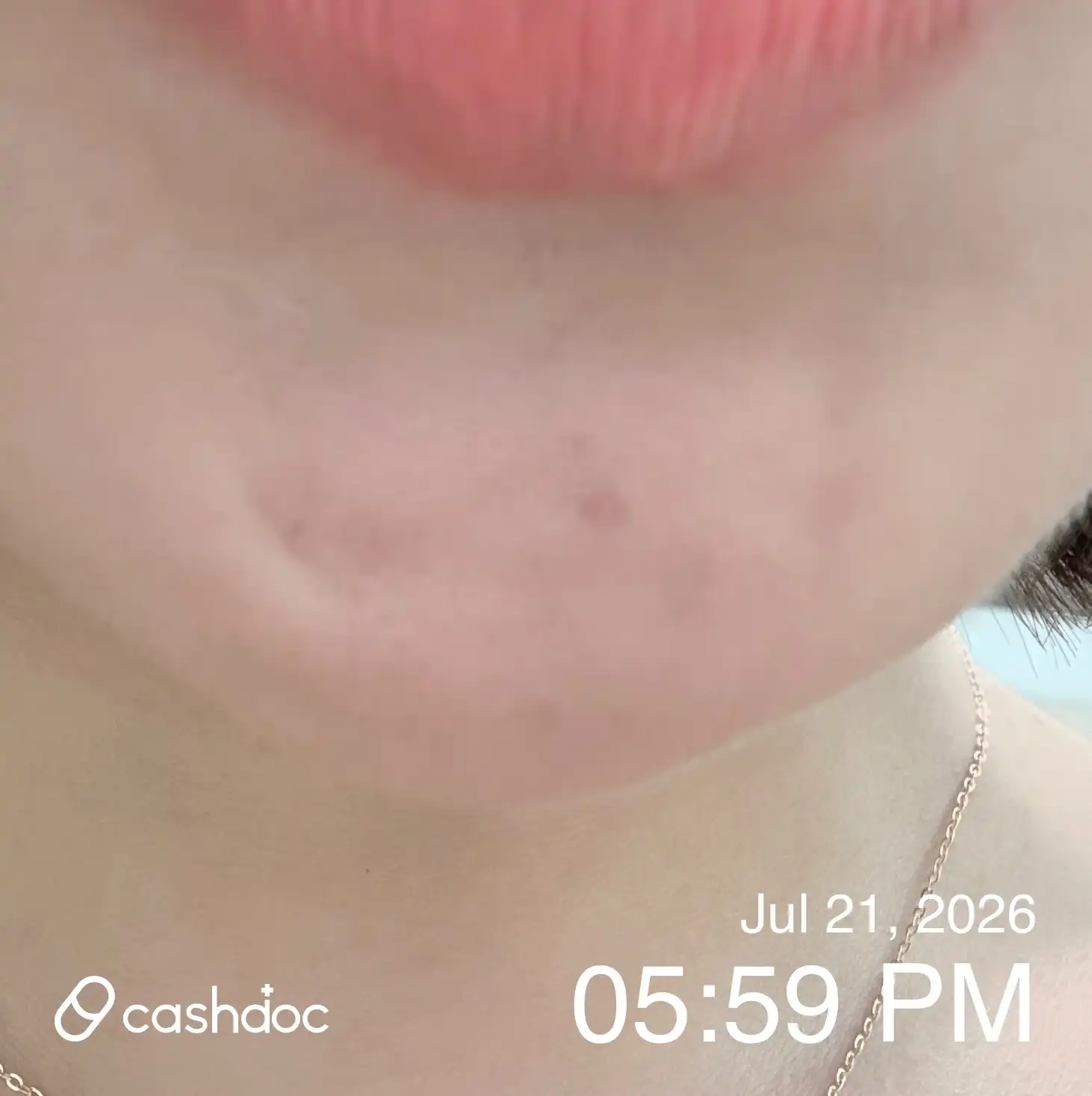 Review photo
