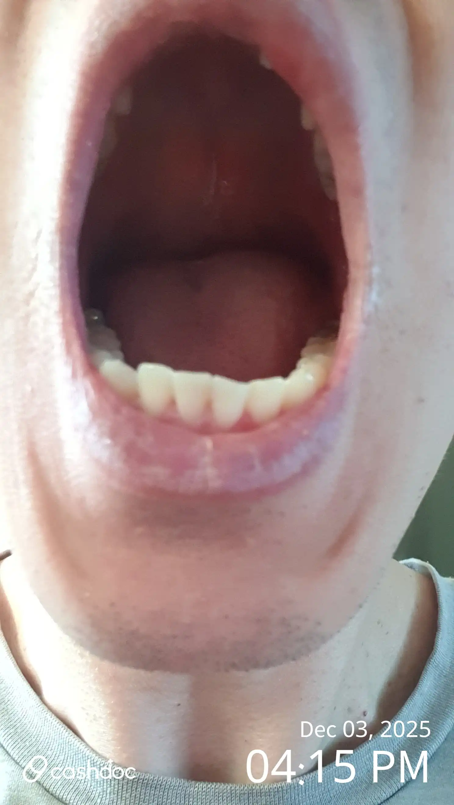 评价照片