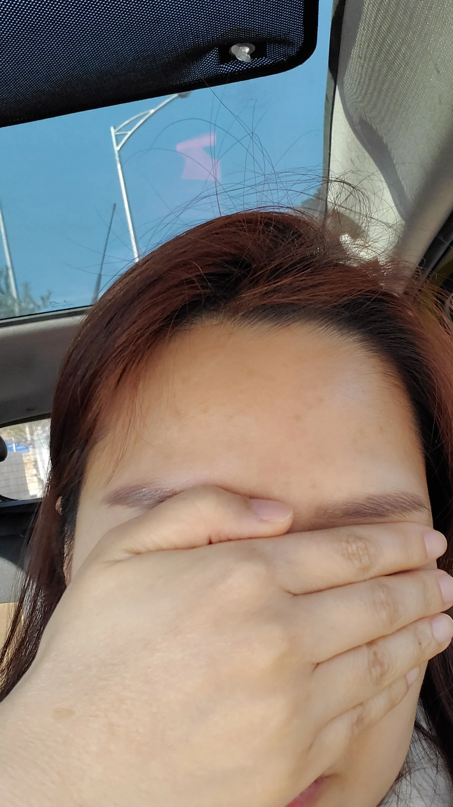 시술 전 — [앵콜]강남점_주름 보톡스 4900원