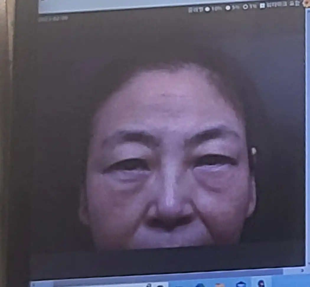 전