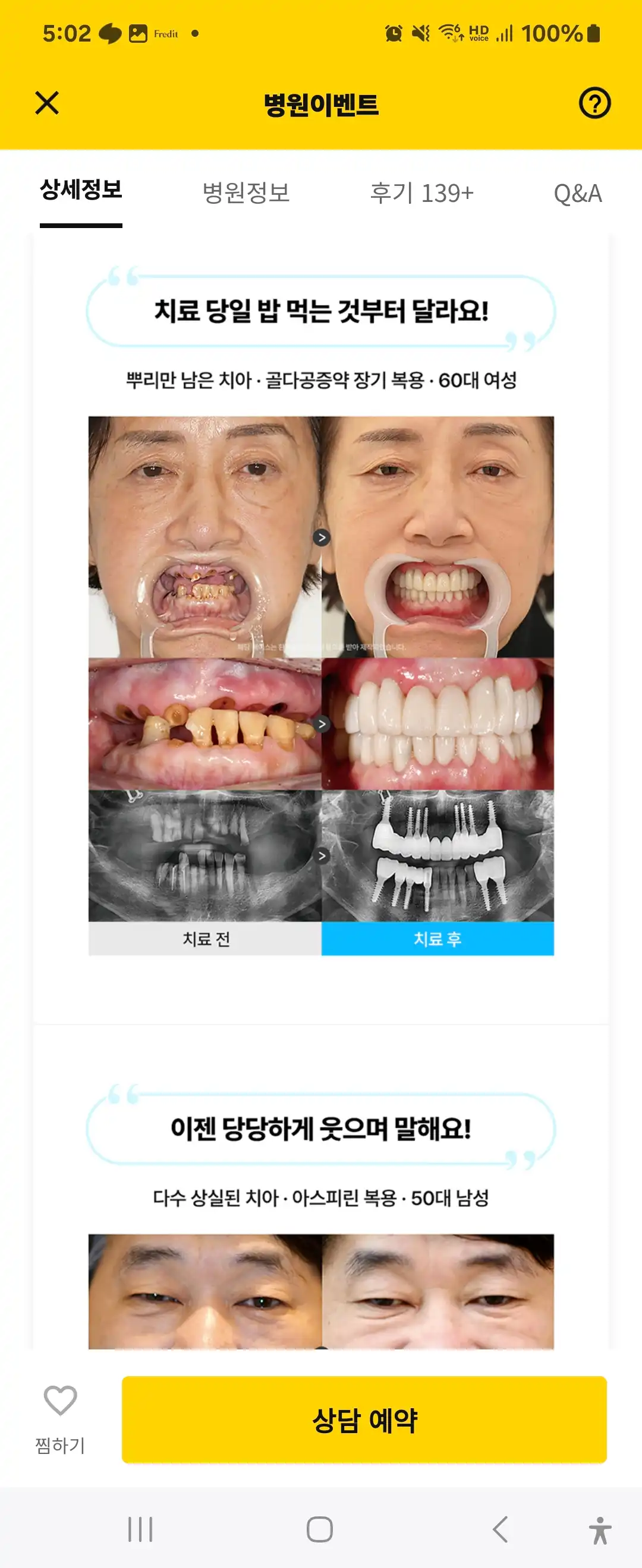 レビュー写真