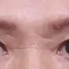 후