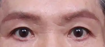 후