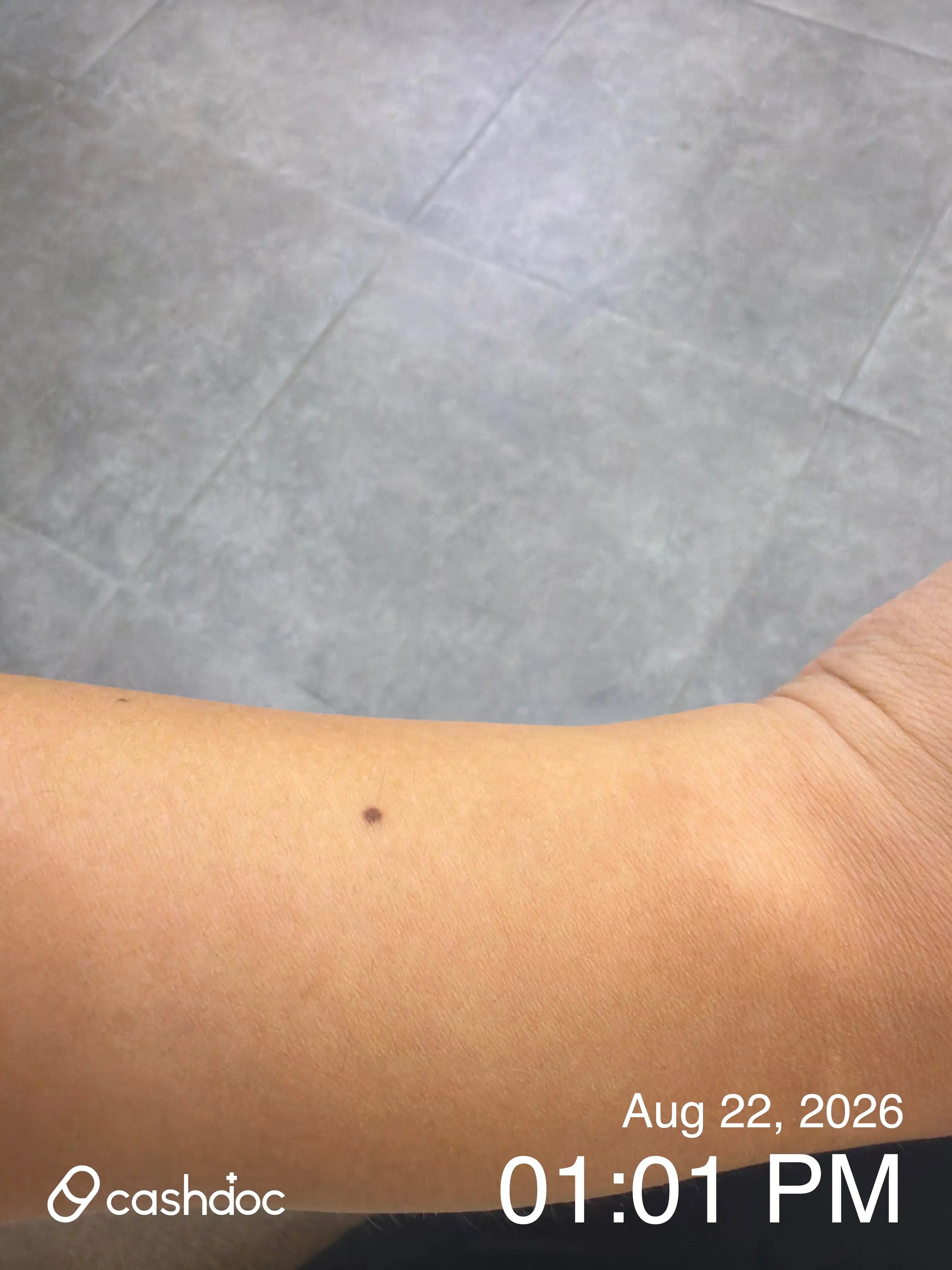 Review photo