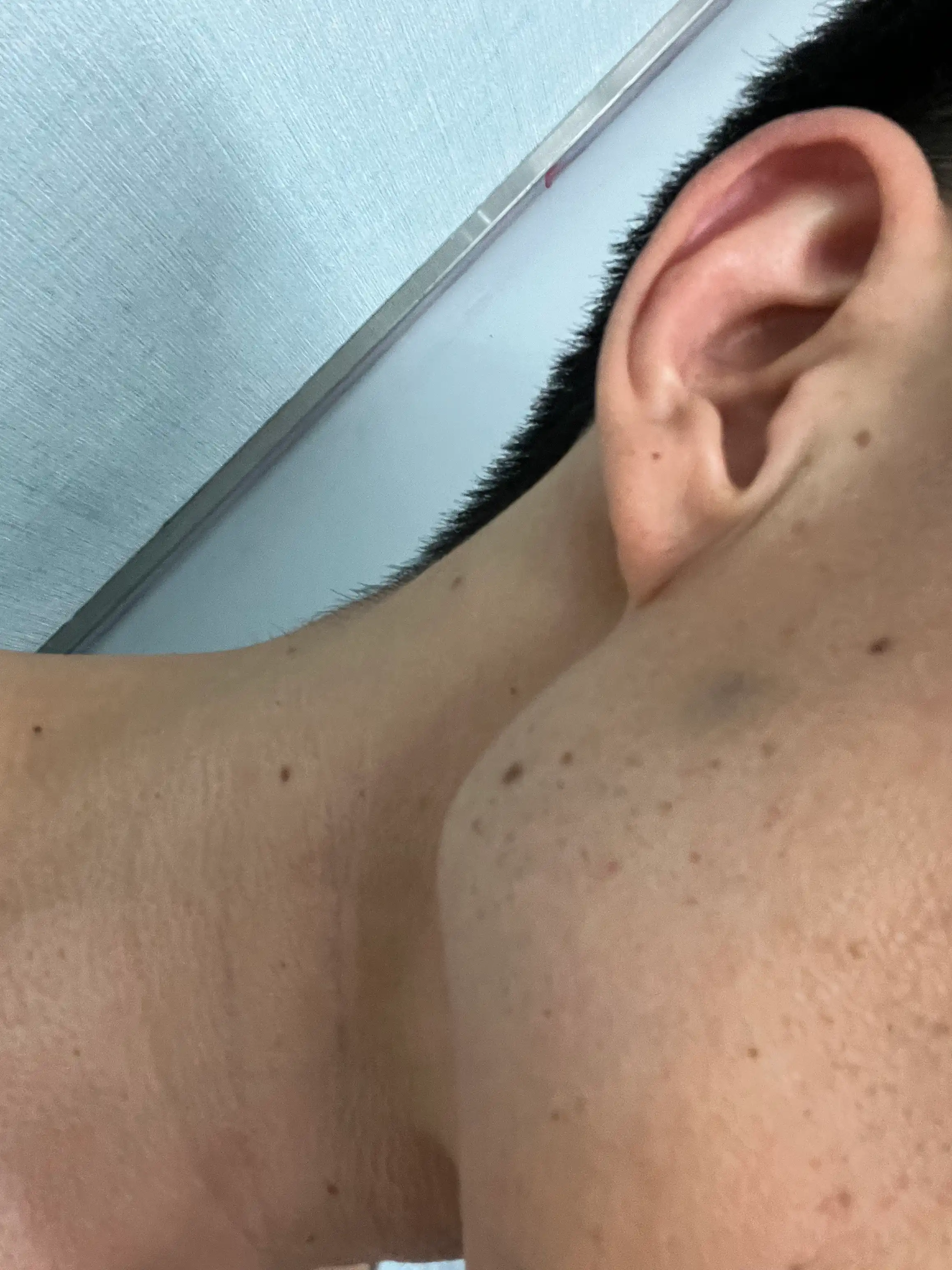 후
