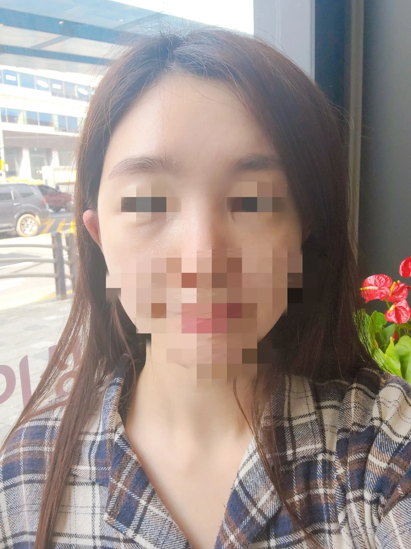 시술 전 사진