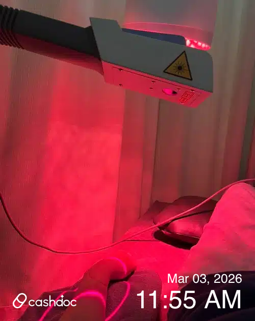 고양시 열린정형외과의원, 손등 결절종 재발 치료 후기