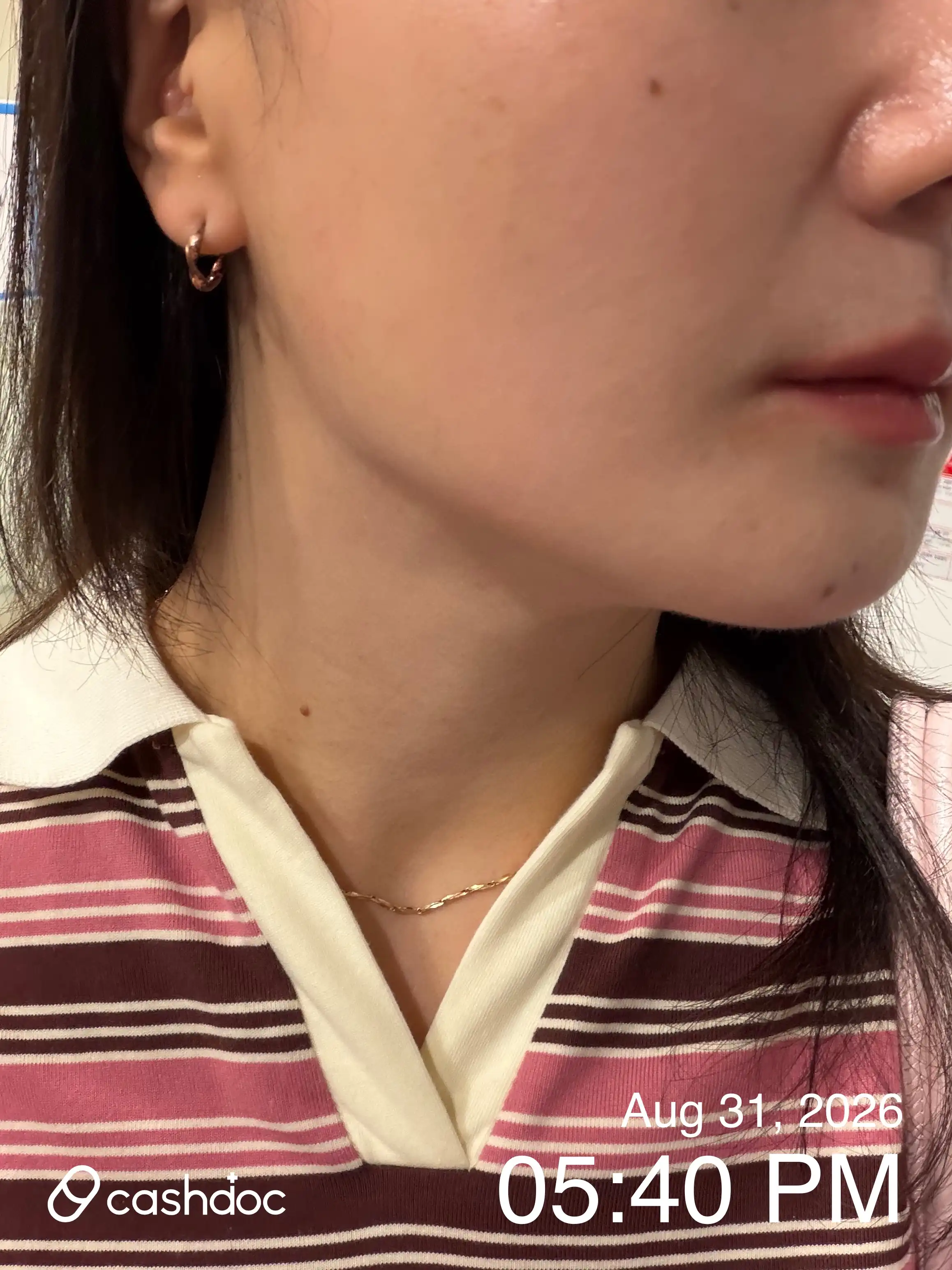 评价照片