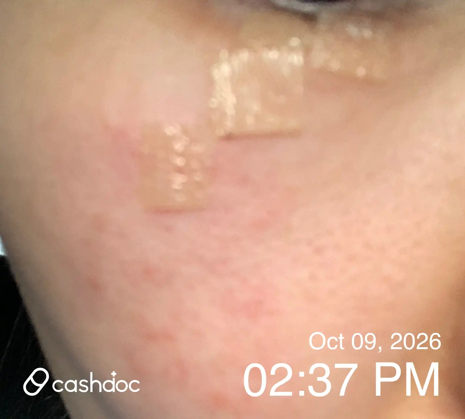 Review photo