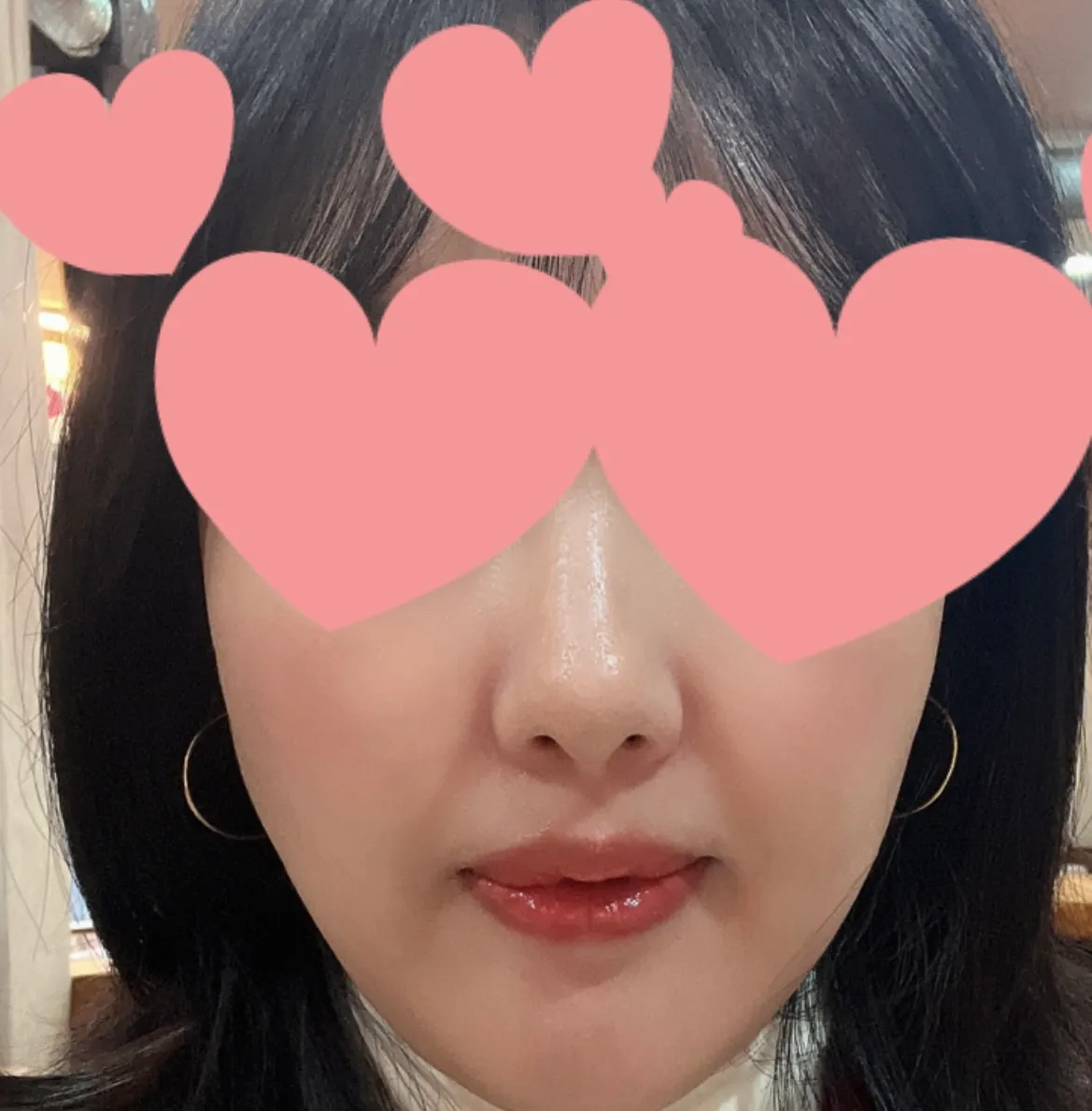项目后 — 舒适睡眠瑞居兰注射剂 2cc