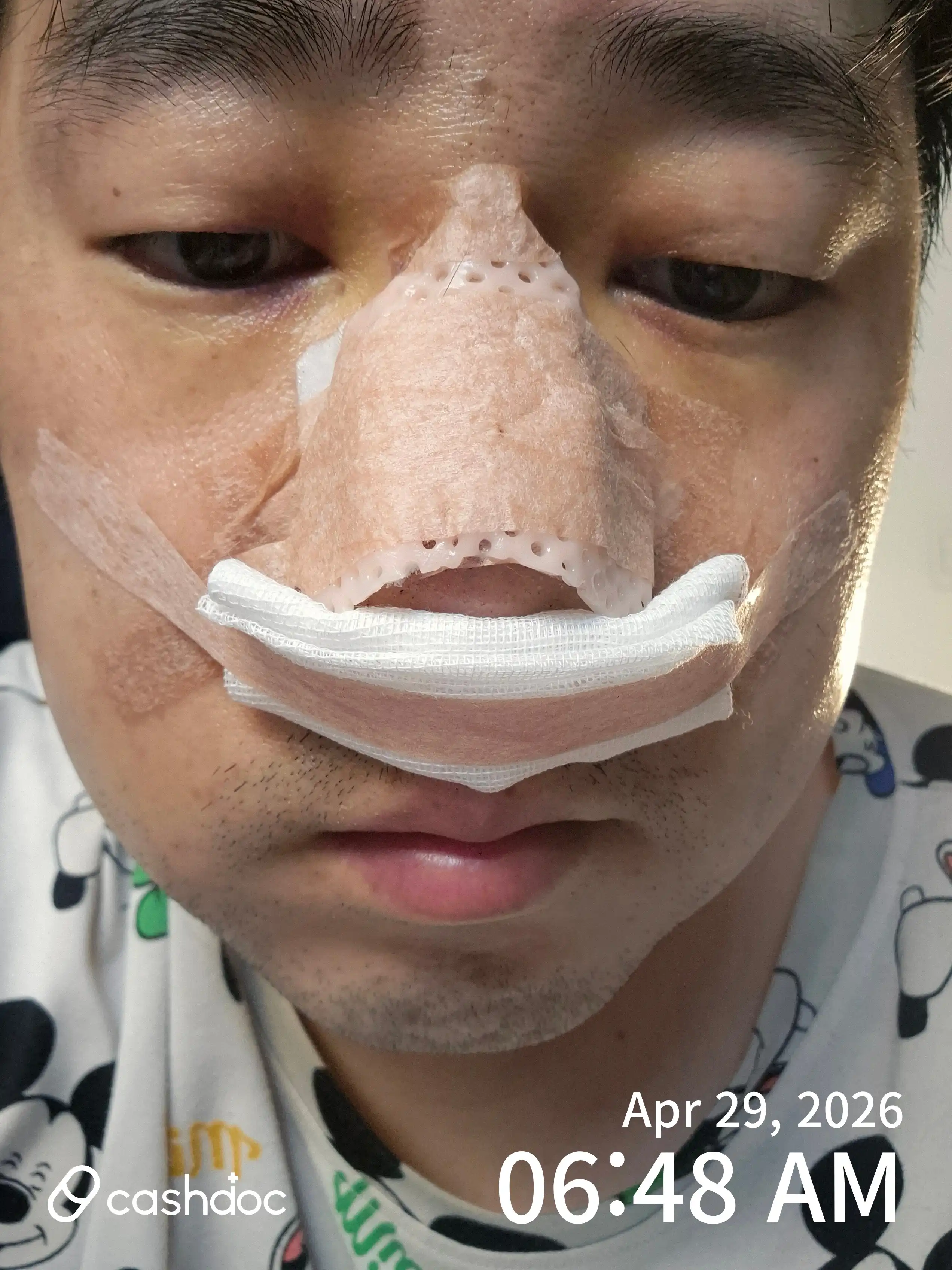 评价照片