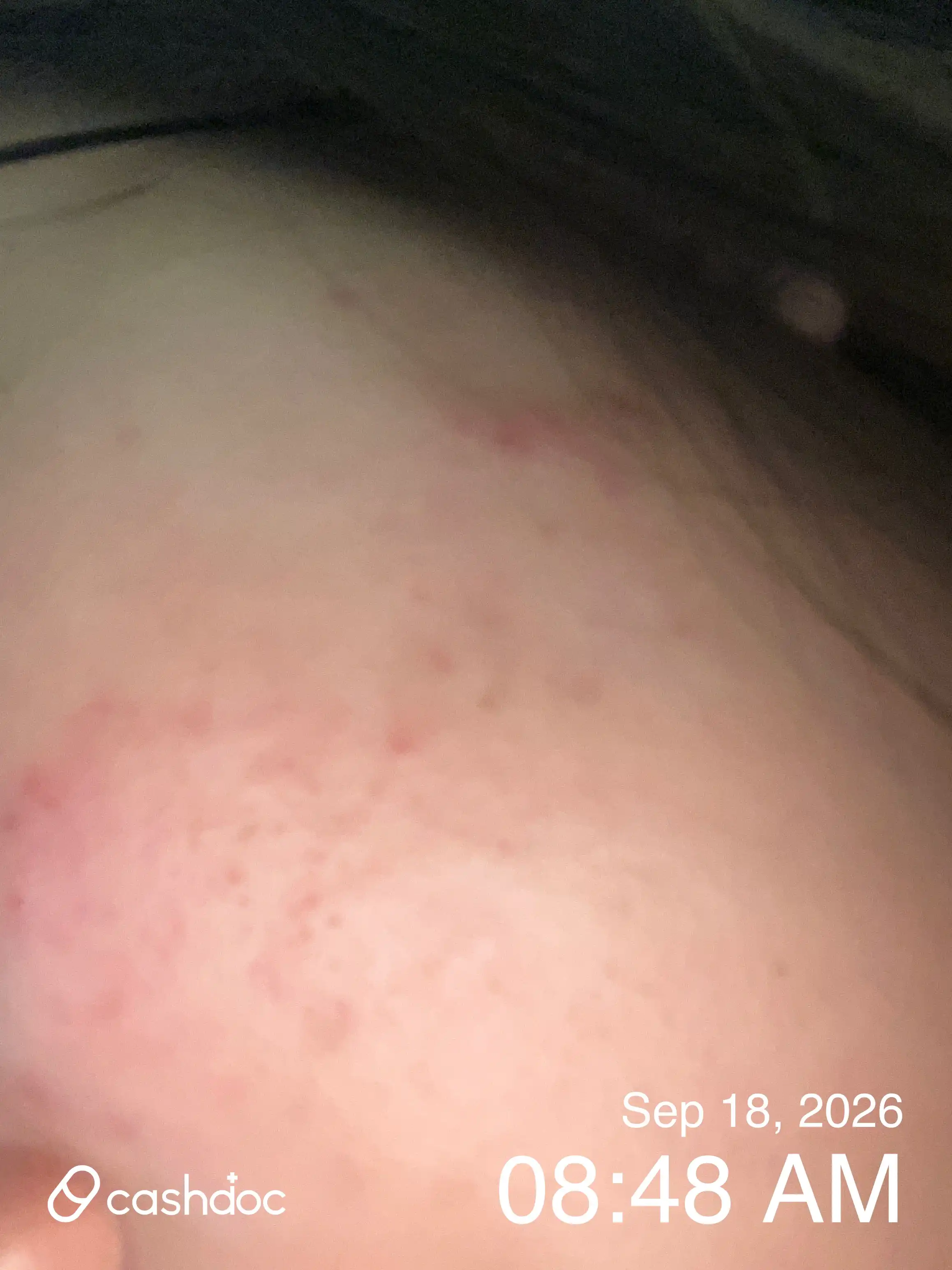 评价照片