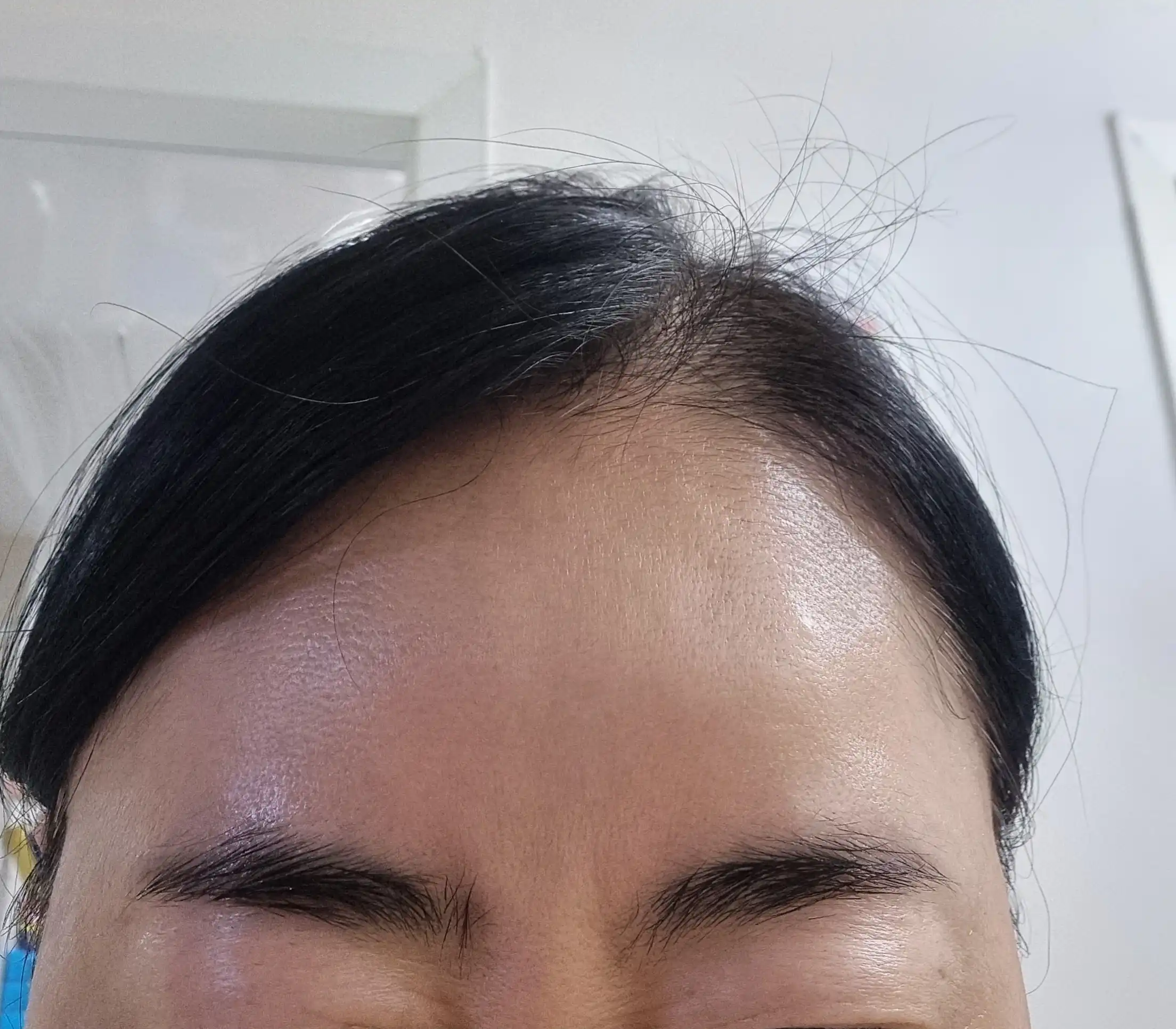 후