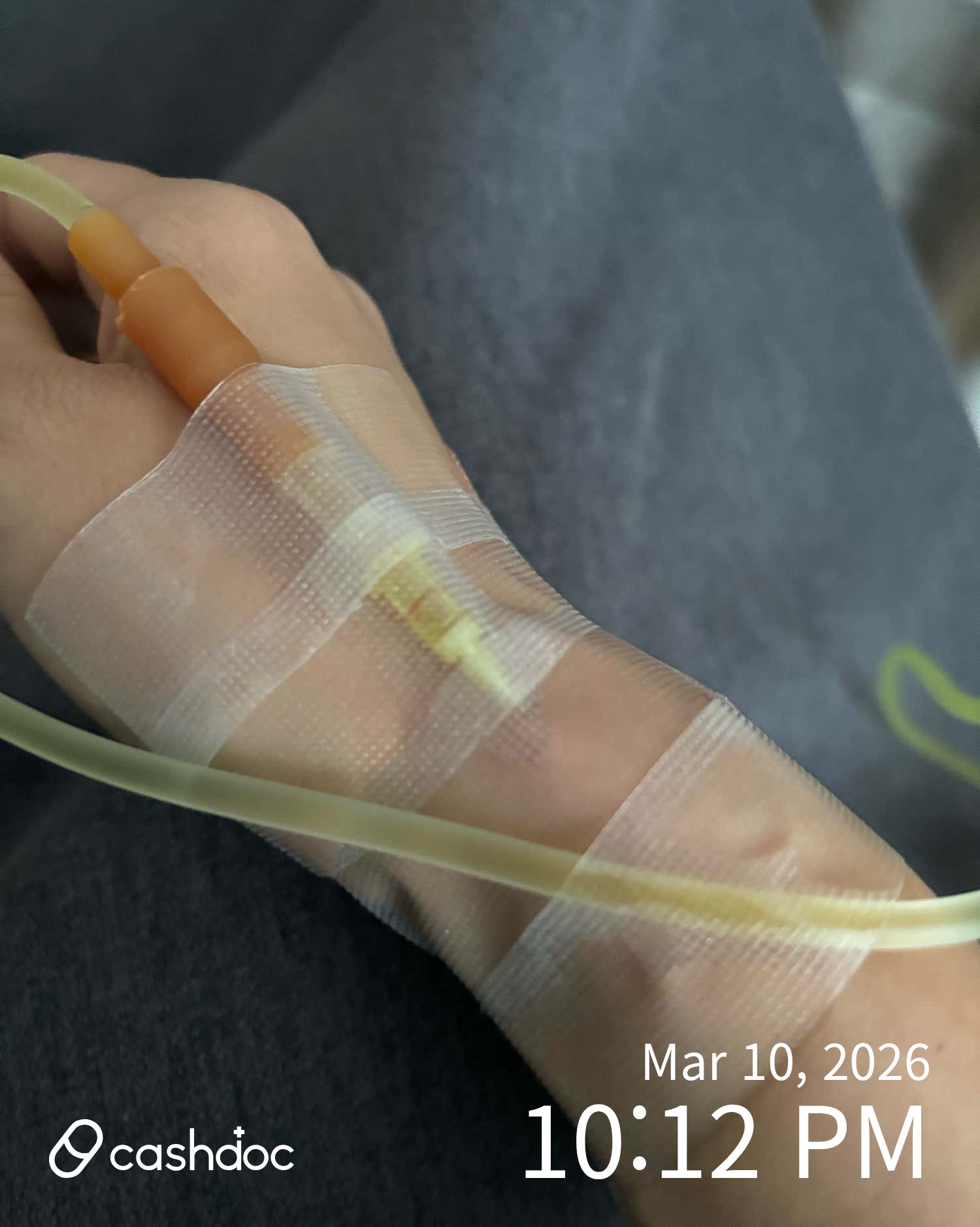 관악구 더나은내과의원, 수액통증 빠이빠이!