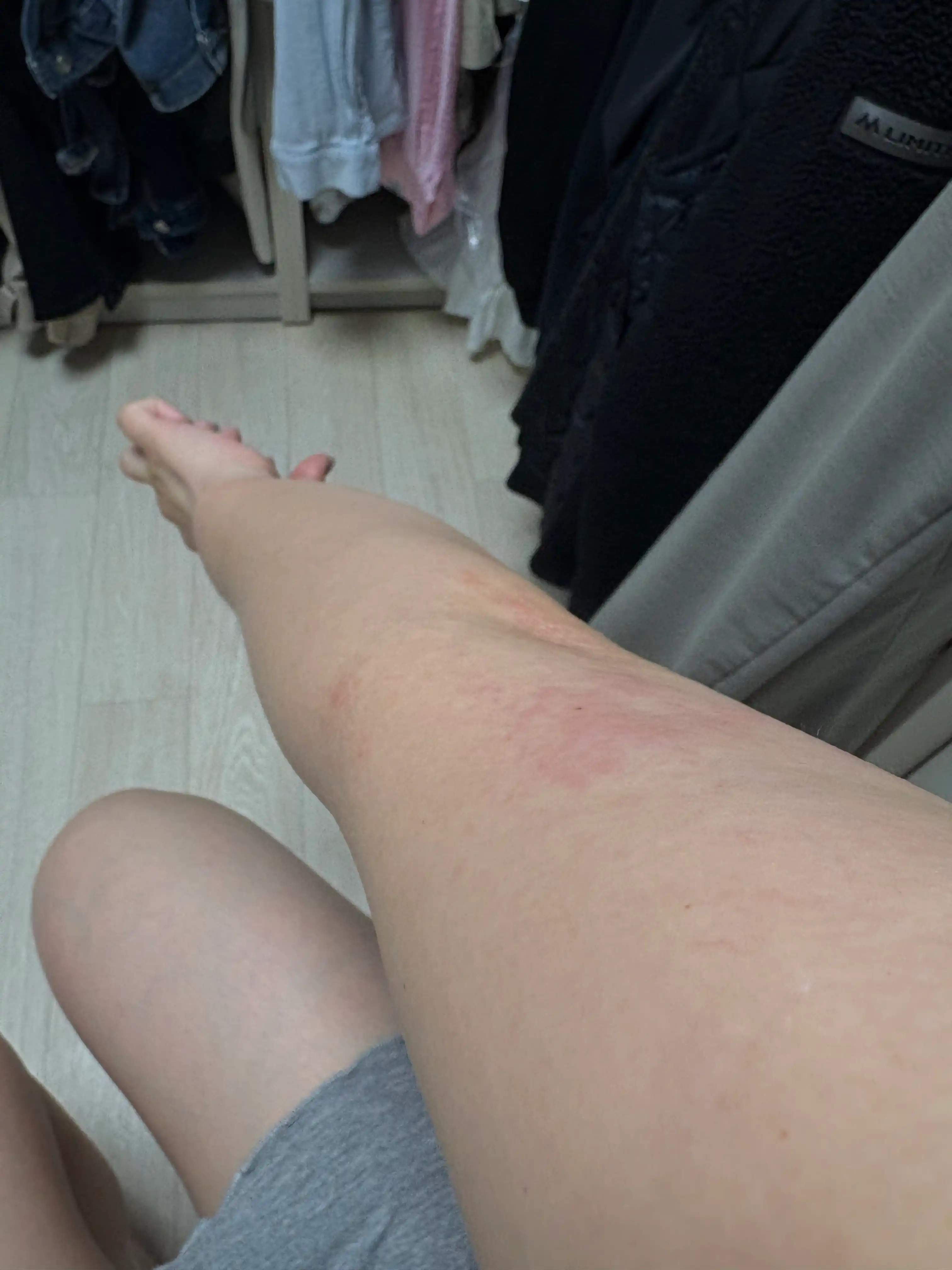 评价照片