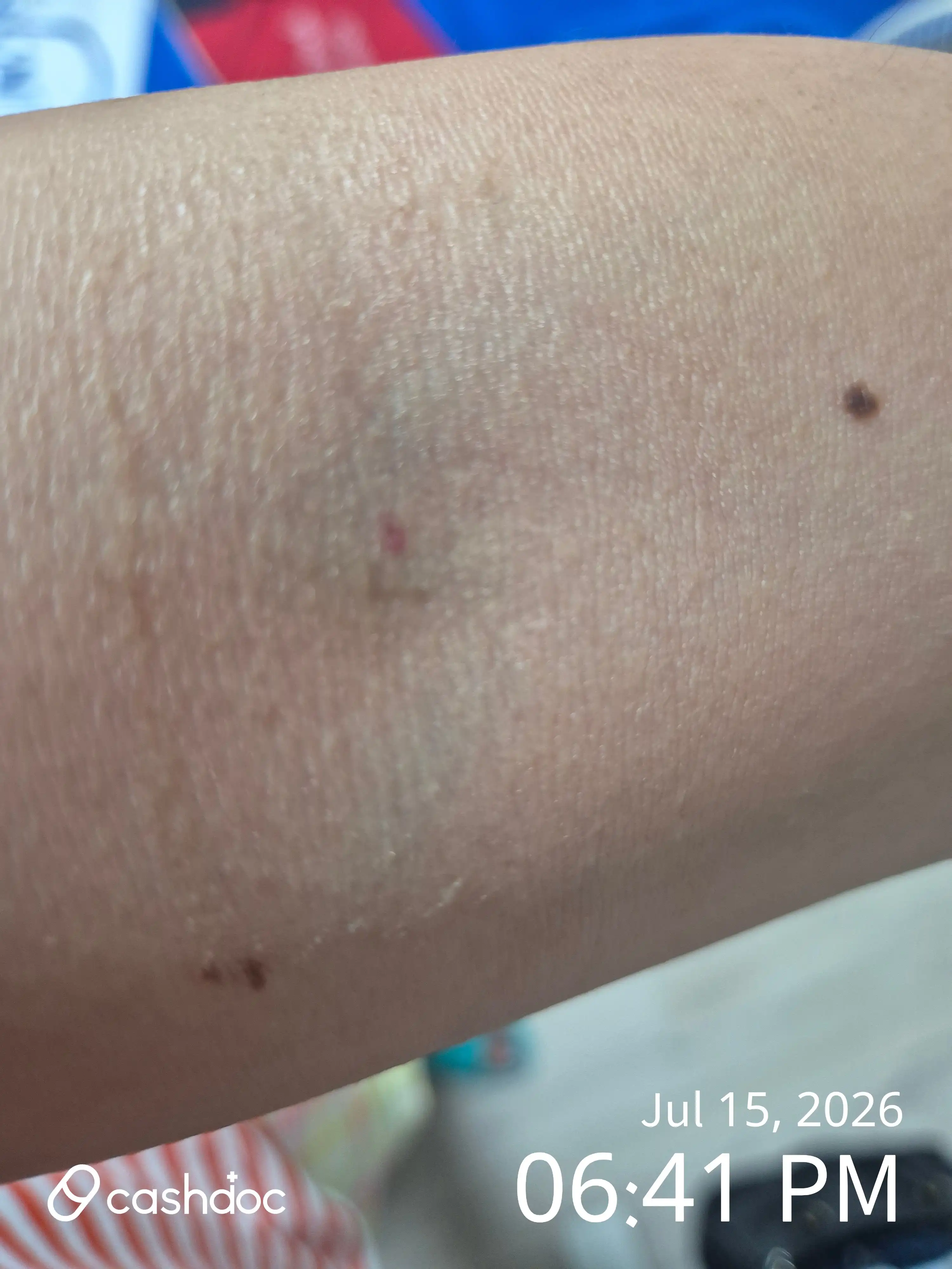 Review photo
