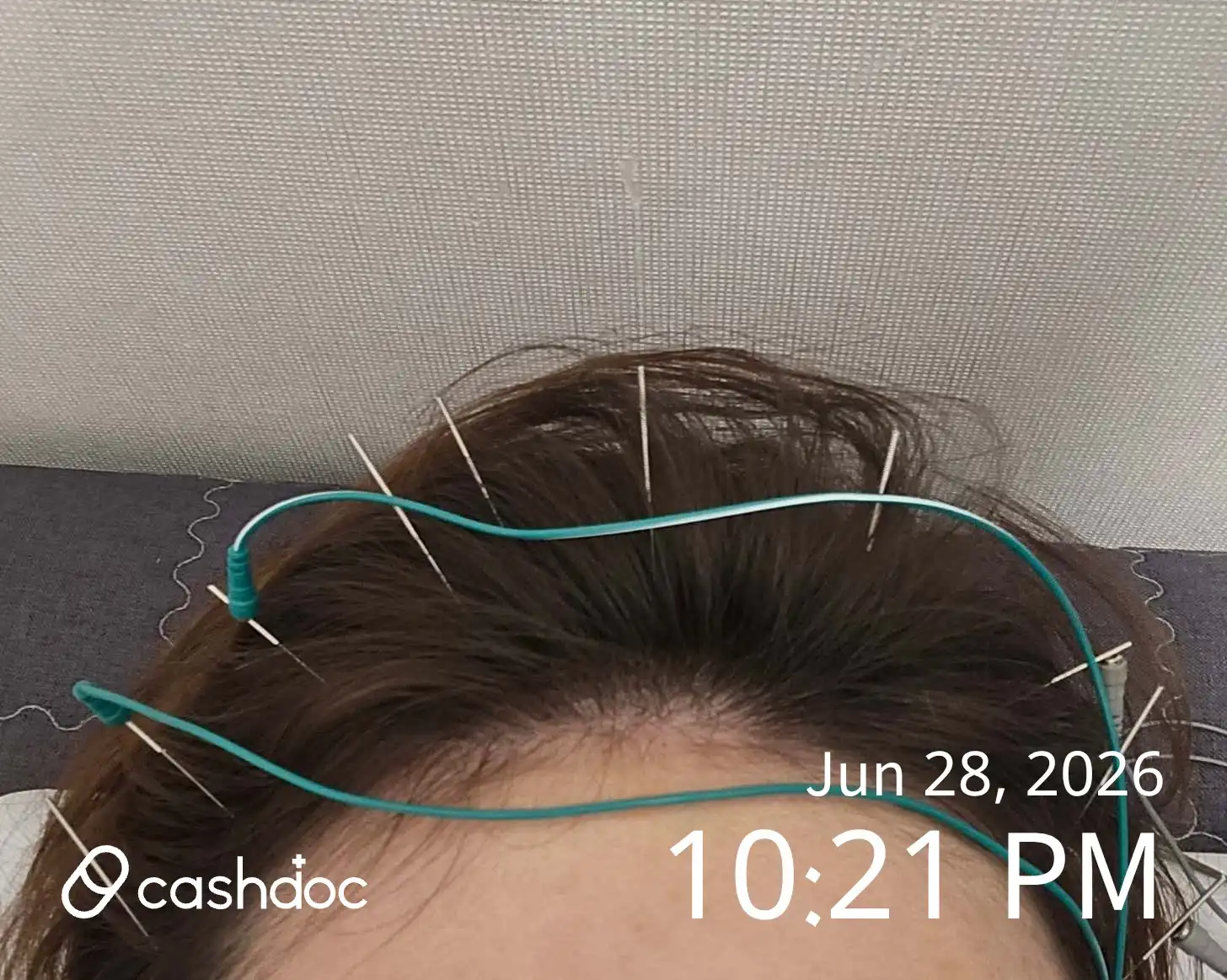 Review photo