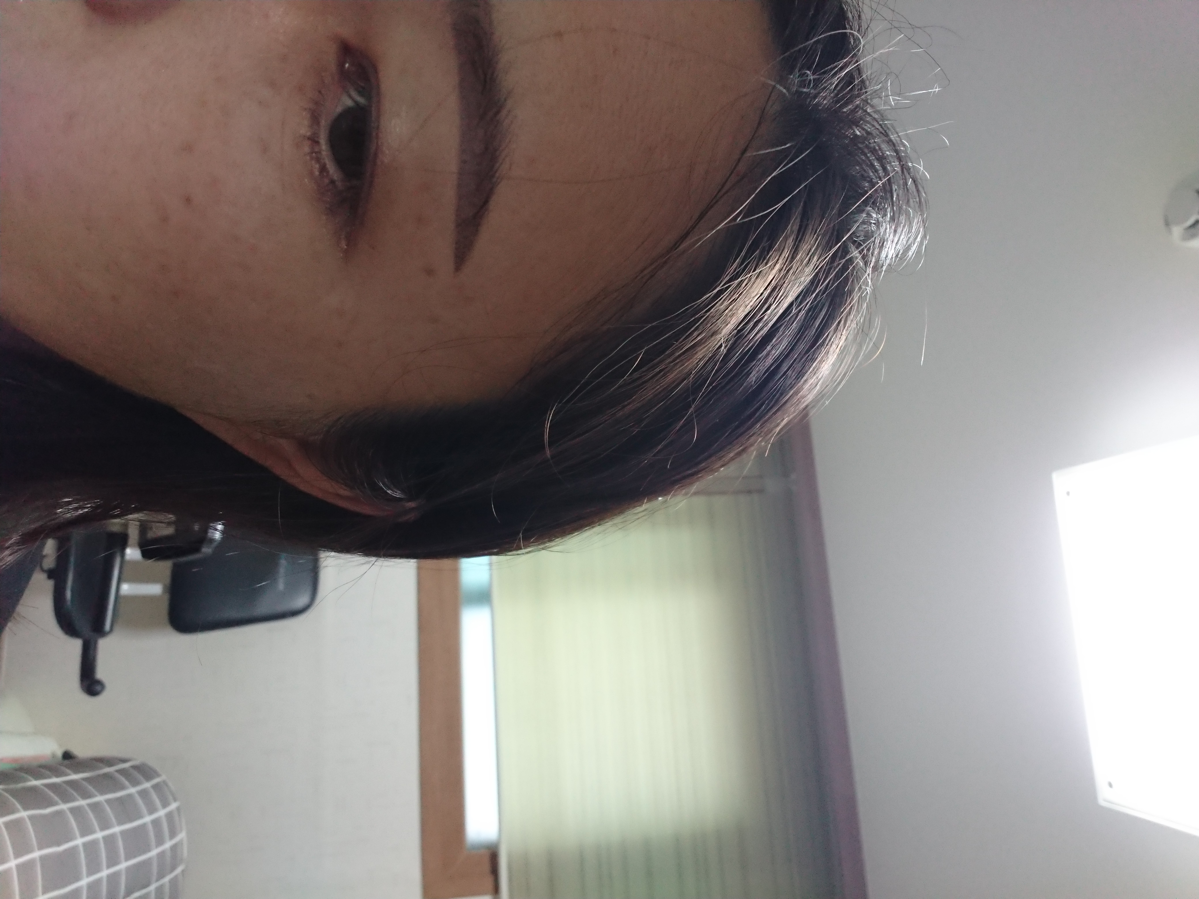 施術前 — 明るい肌を作る