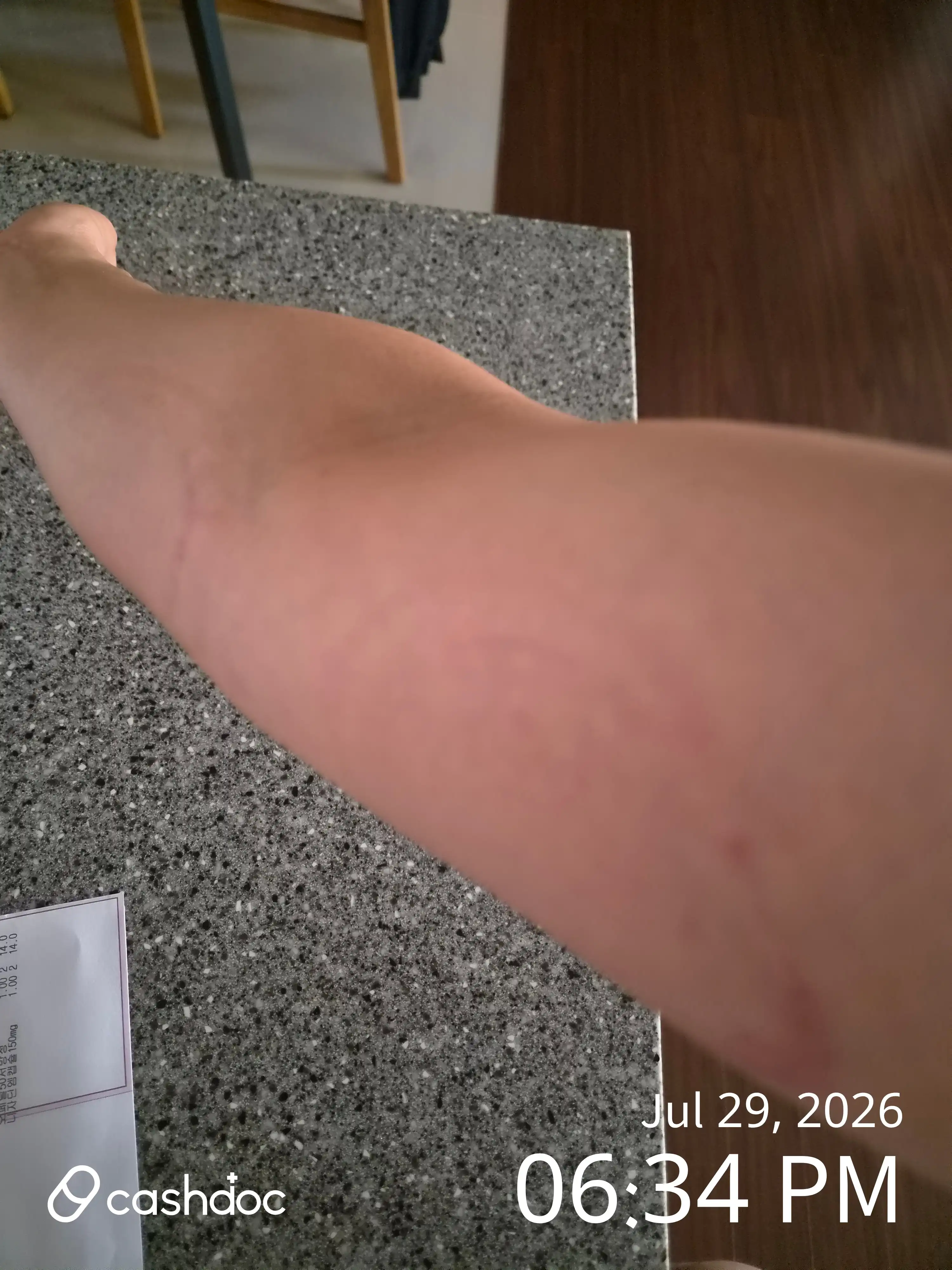 Review photo