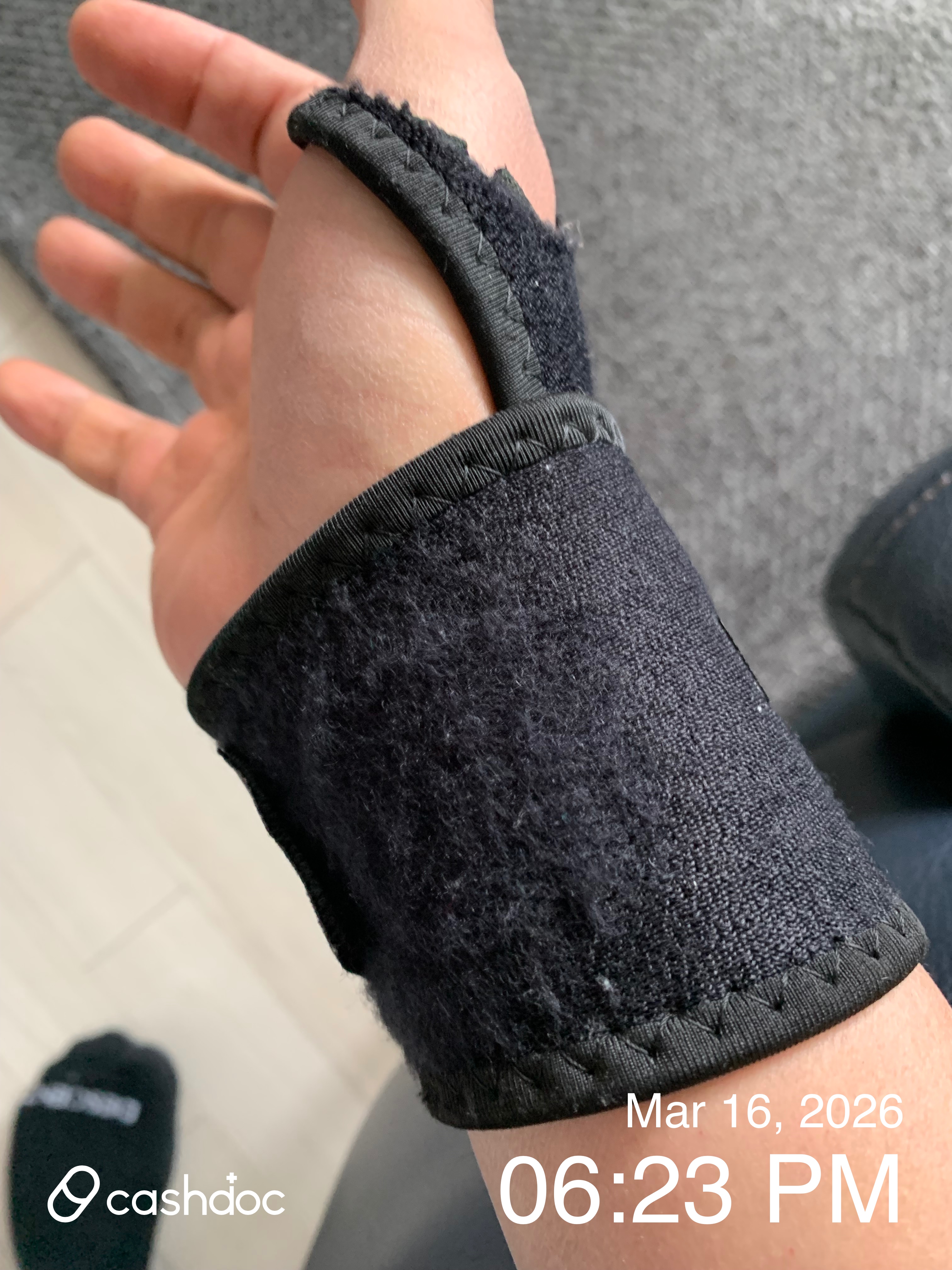 성북구 정릉효자마취통증의학과, 아들 손목 타박상 치료 후기