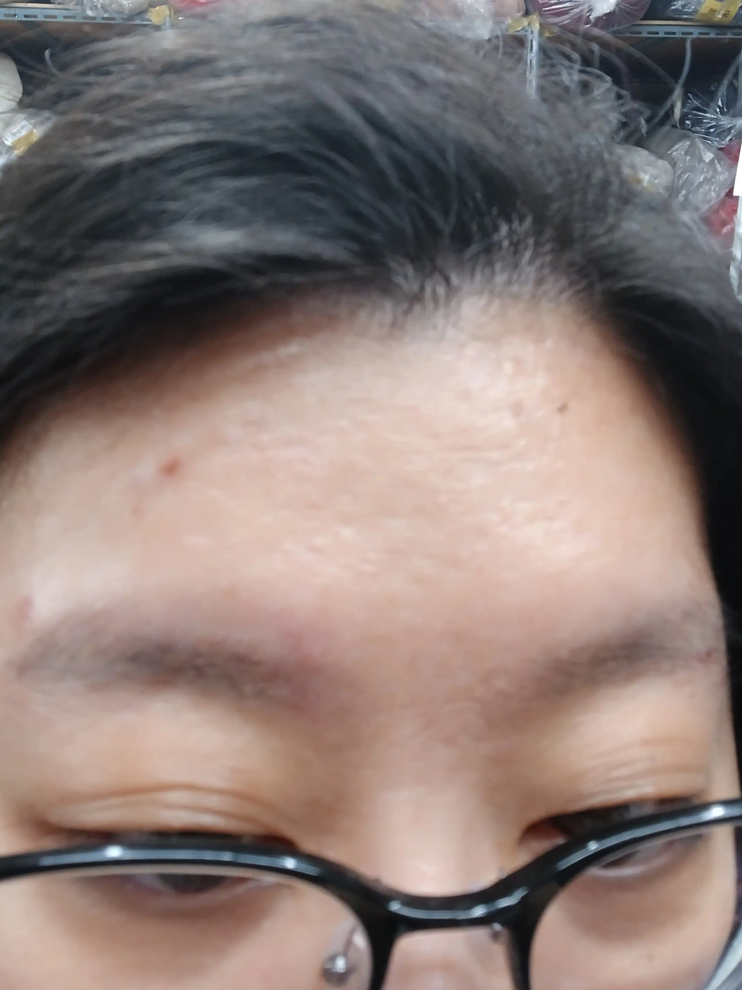 후