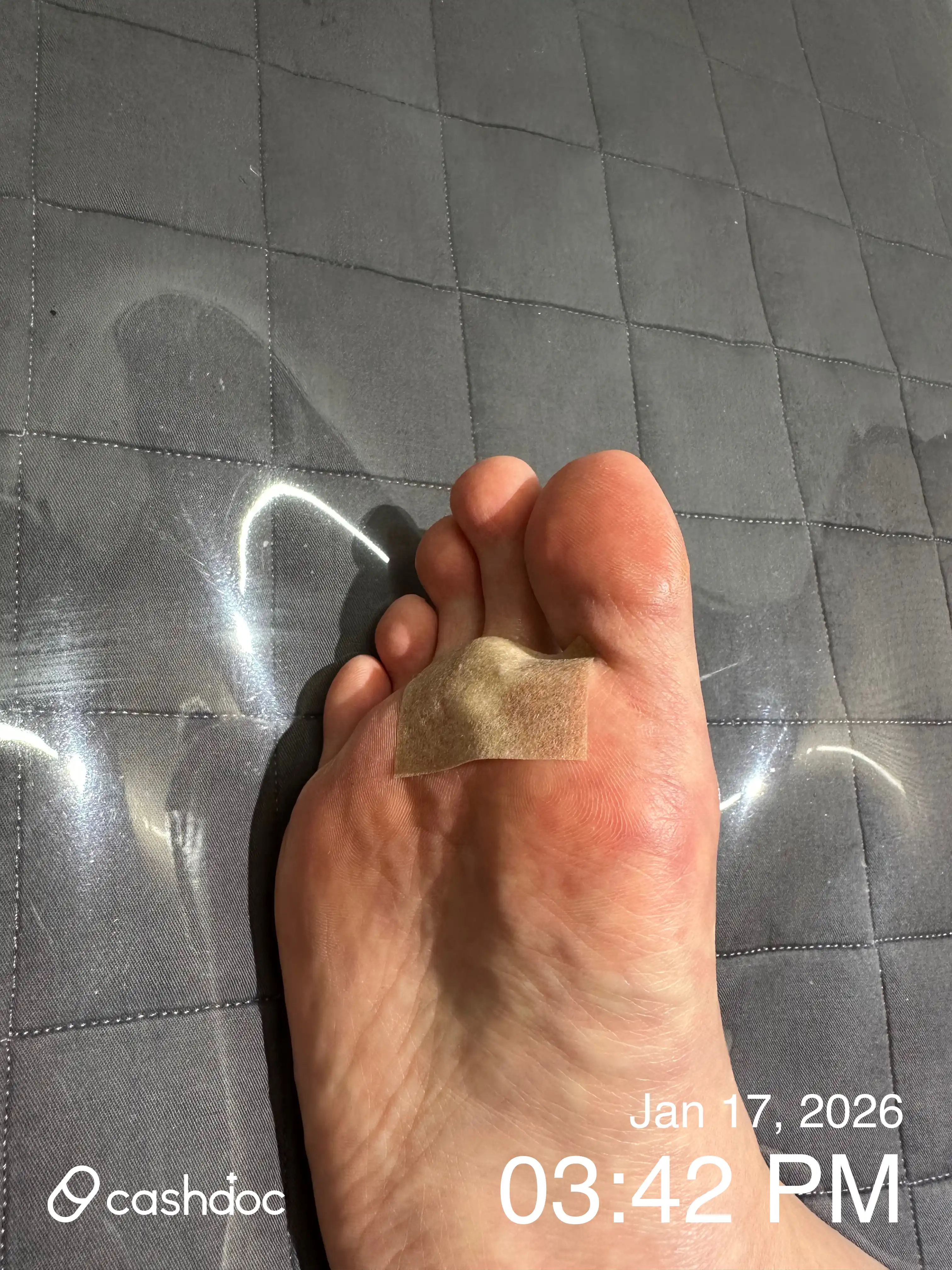 Review photo