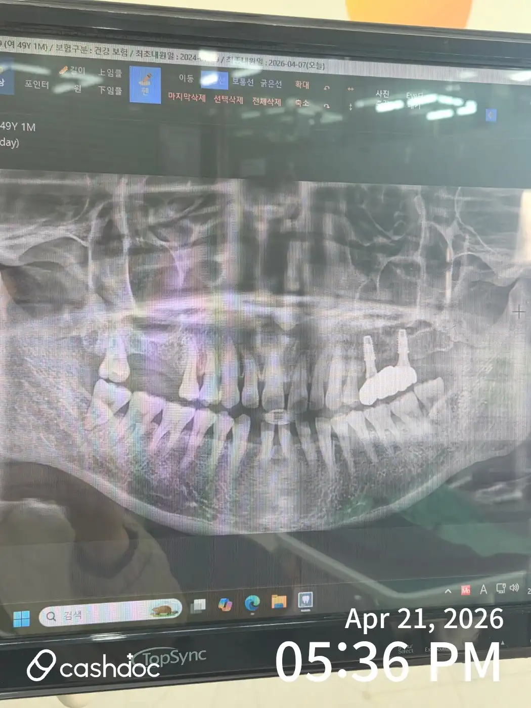 Review photo