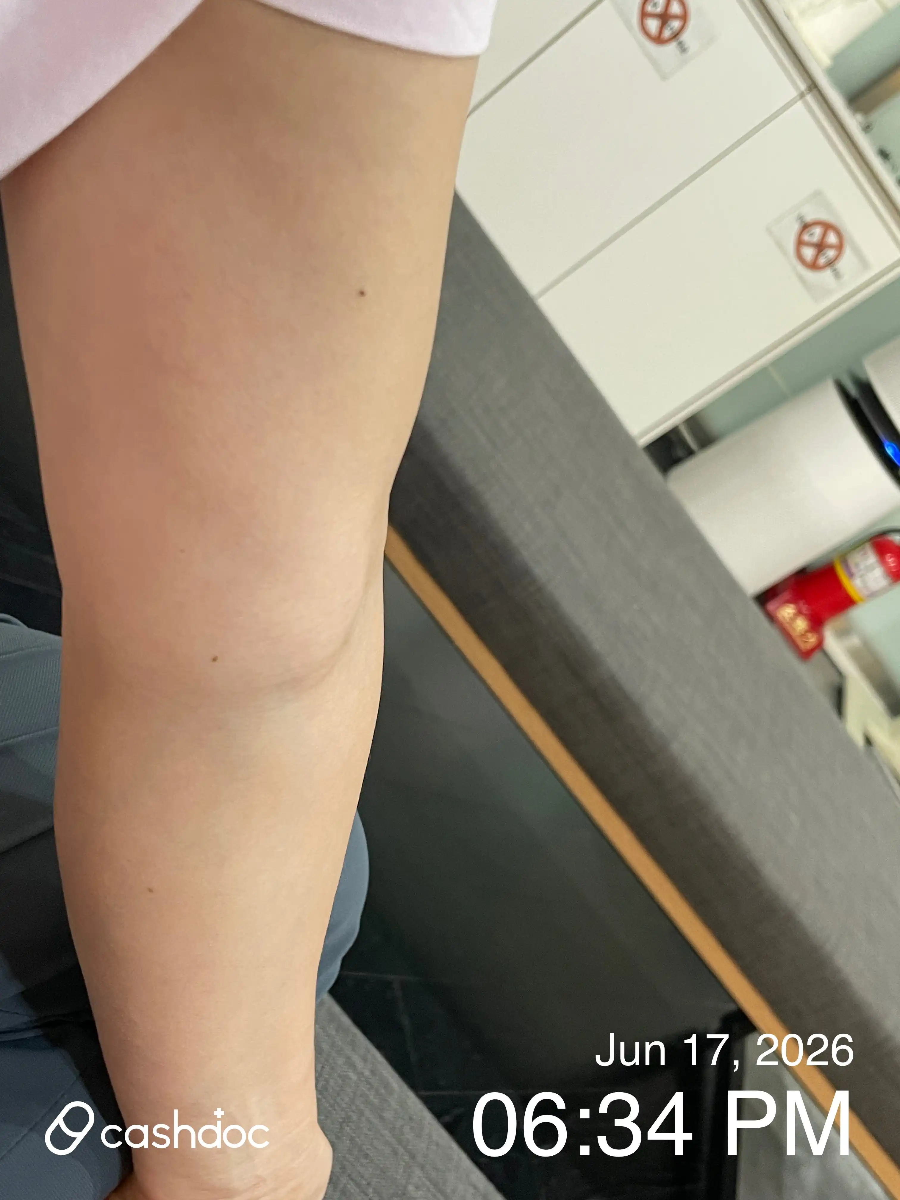 Review photo
