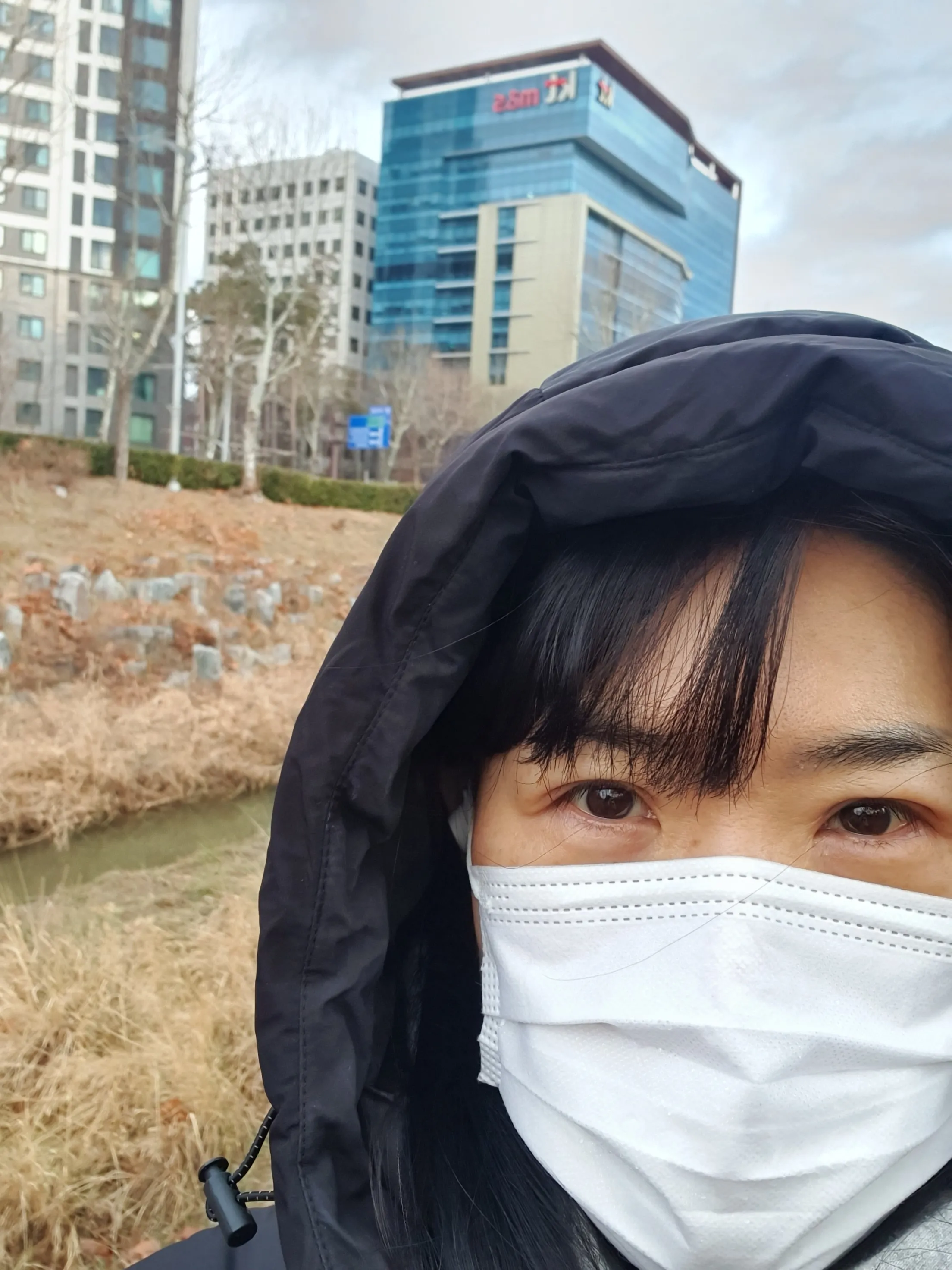 시술 전 — 강남점_주름 보톡스 4,900원