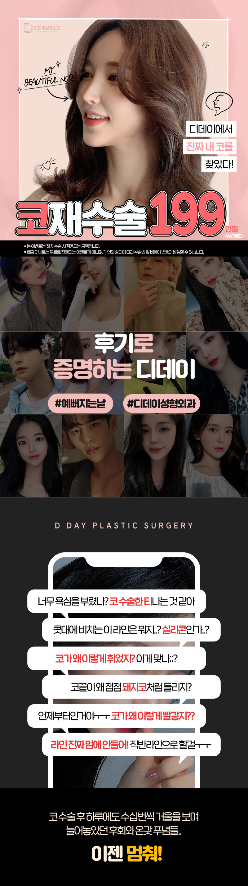 디데이성형외과의원 💖디데이 코재수술💖 이벤트, 시술 상세 이미지