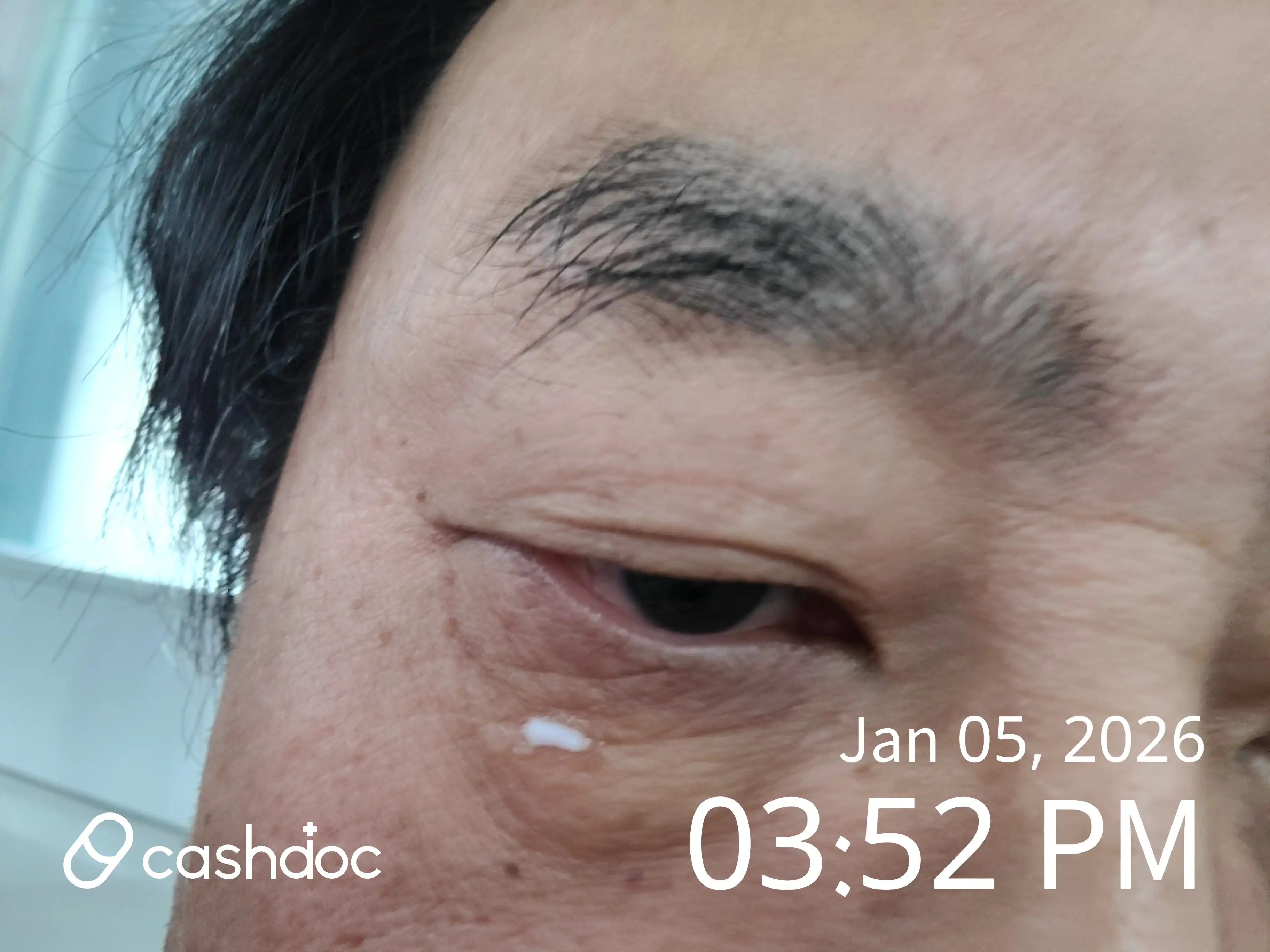 Review photo