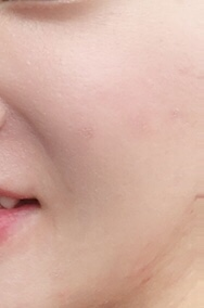 후