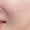 후