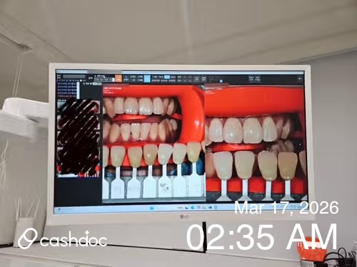 종로구 서울새린치과의원, 치아미백 후 자연스럽게 만족해요