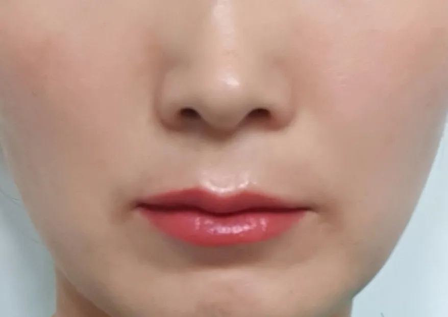 시술 후 — 섹시큐티 입술반영구화장!